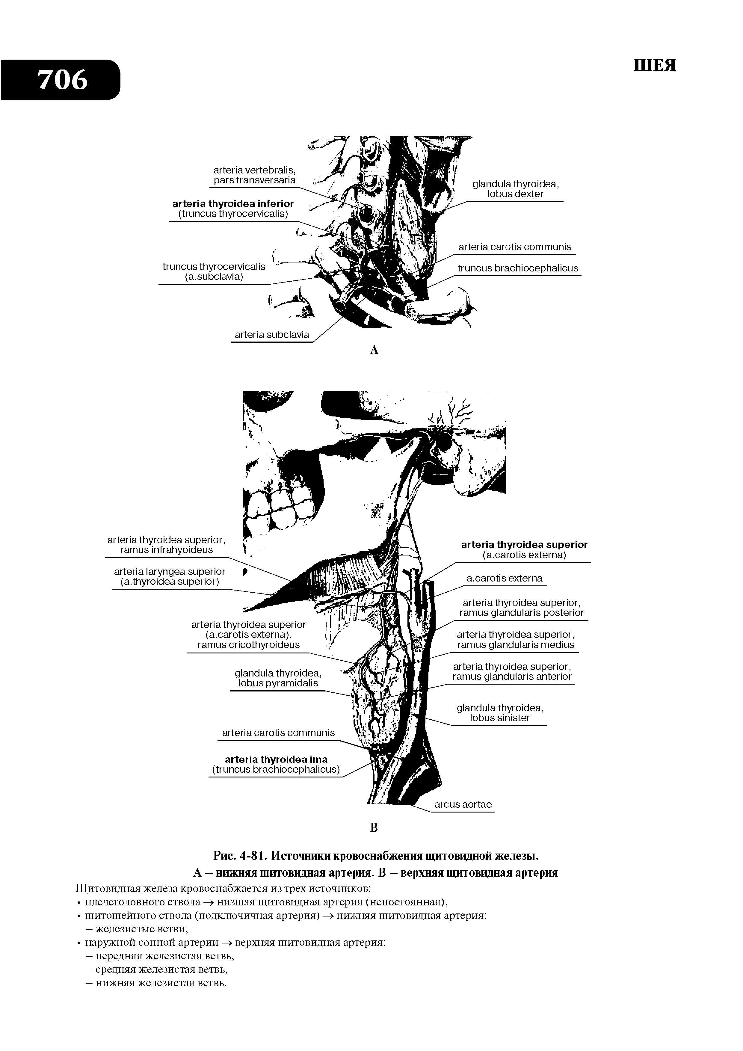 Рис. 4-81. Источники кровоснабжения щитовидной железы. А — нижняя щитовидная артерия. В — верхняя щитовидная артерия...