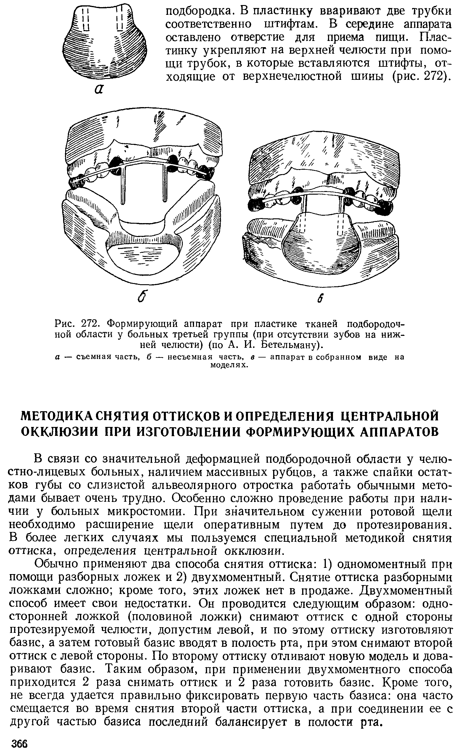 Рис. 272. Формирующий аппарат при пластике тканей подбородочной области у больных третьей группы (при отсутствии зубов на нижней челюсти) (по А. И. Бетельману).