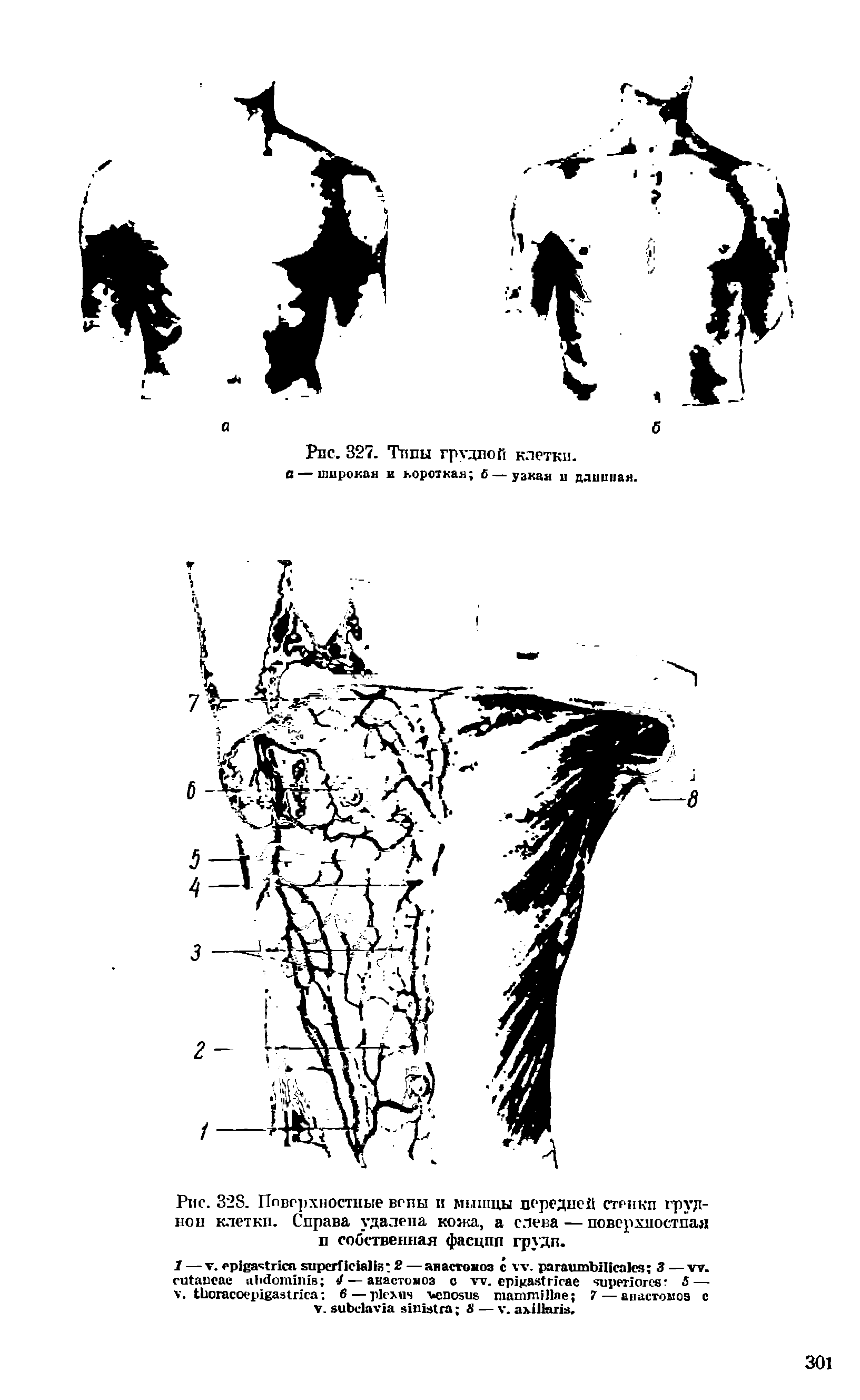 Рис. 328. Поверхностные вспы в мышцы передней стенкп груд-нон клетки. Справа удалена кожа, а слева — поверхностная п собственная фасции груди.