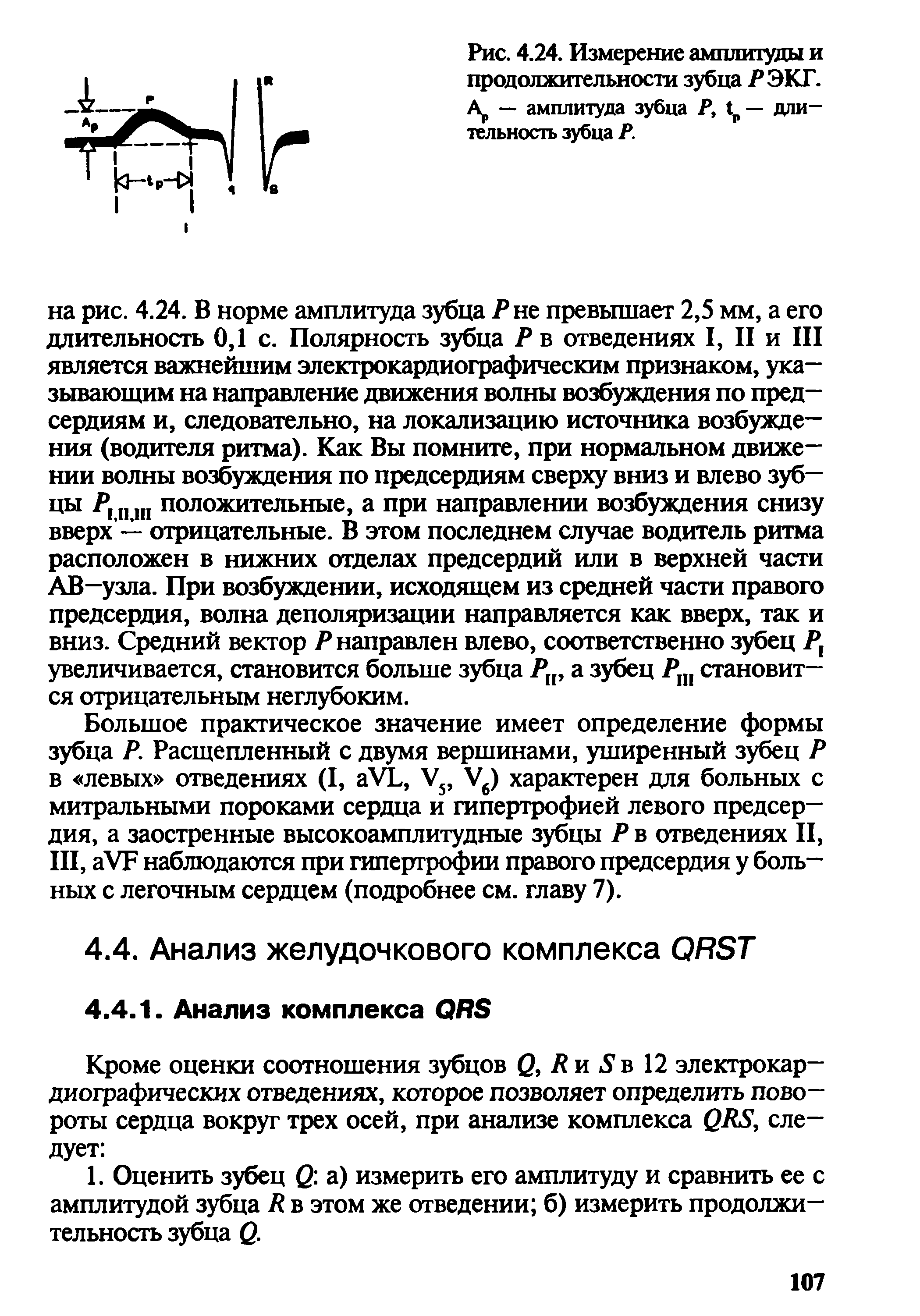 Рис. 4.24. Измерение амплитуды и продолжительности зубца РЭКГ. Ар — амплитуда зубца Р, 1р— длительность зубца Р.