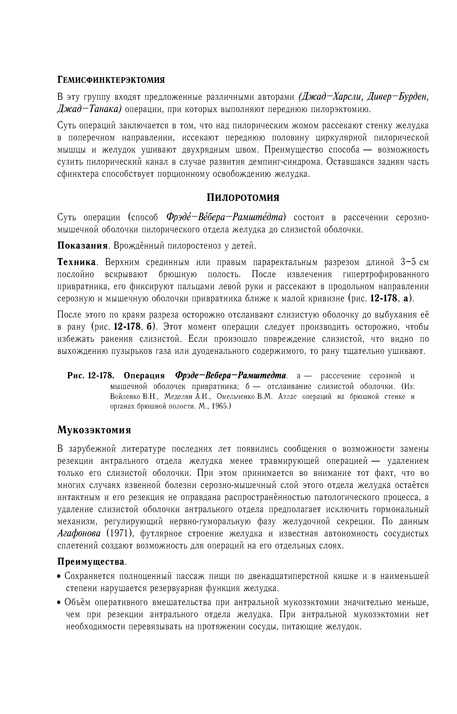 Рис. 12-178. Операция Фрэде—Вебера—Рамштедта. а — рассечение серозной и мышечной оболочек привратника б — отслаивание слизистой оболочки. (Из Войленко В.Н., Меделян А.И., Омельченко В.М. Атлас операций на брюшной стенке и органах брюшной полости. М., 1965.)...