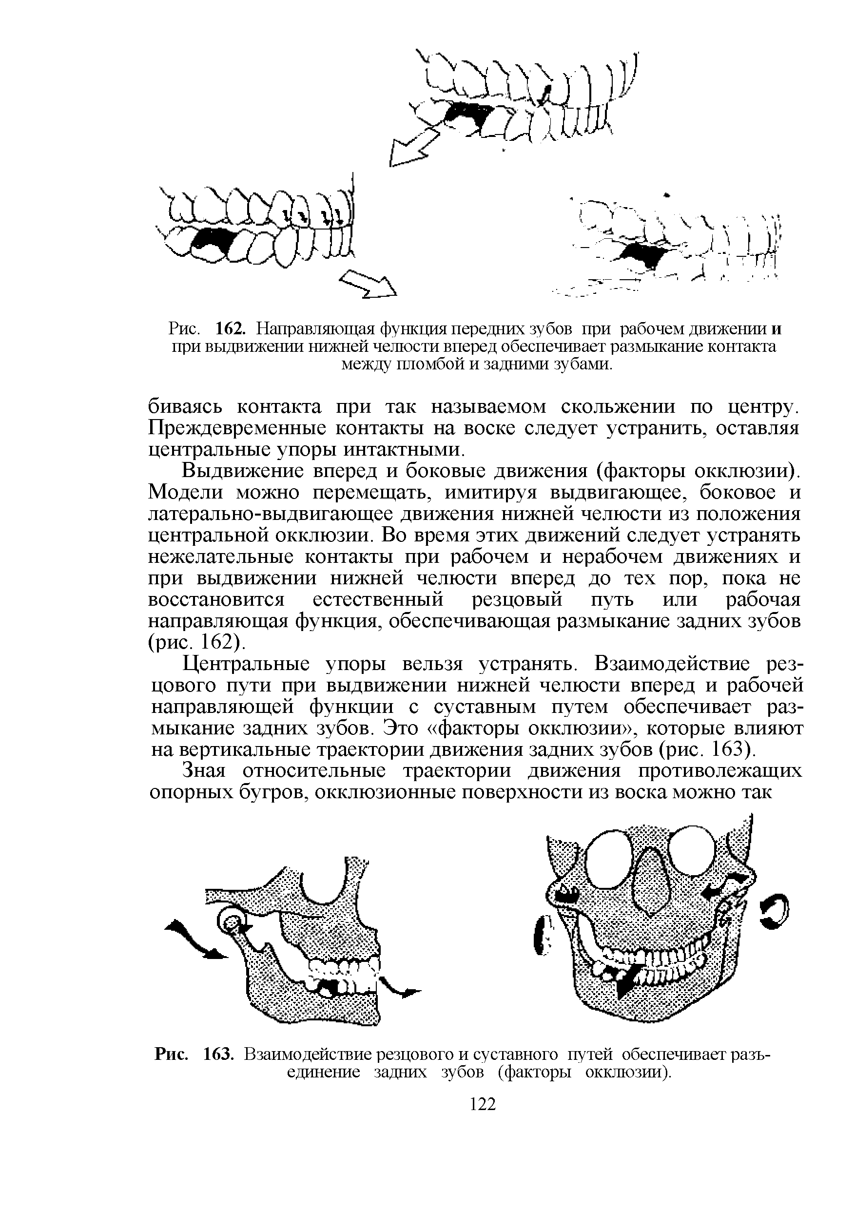Рис. 163. Взаимодействие резцового и суставного путей обеспечивает разъединение задних зубов (факторы окклюзии).