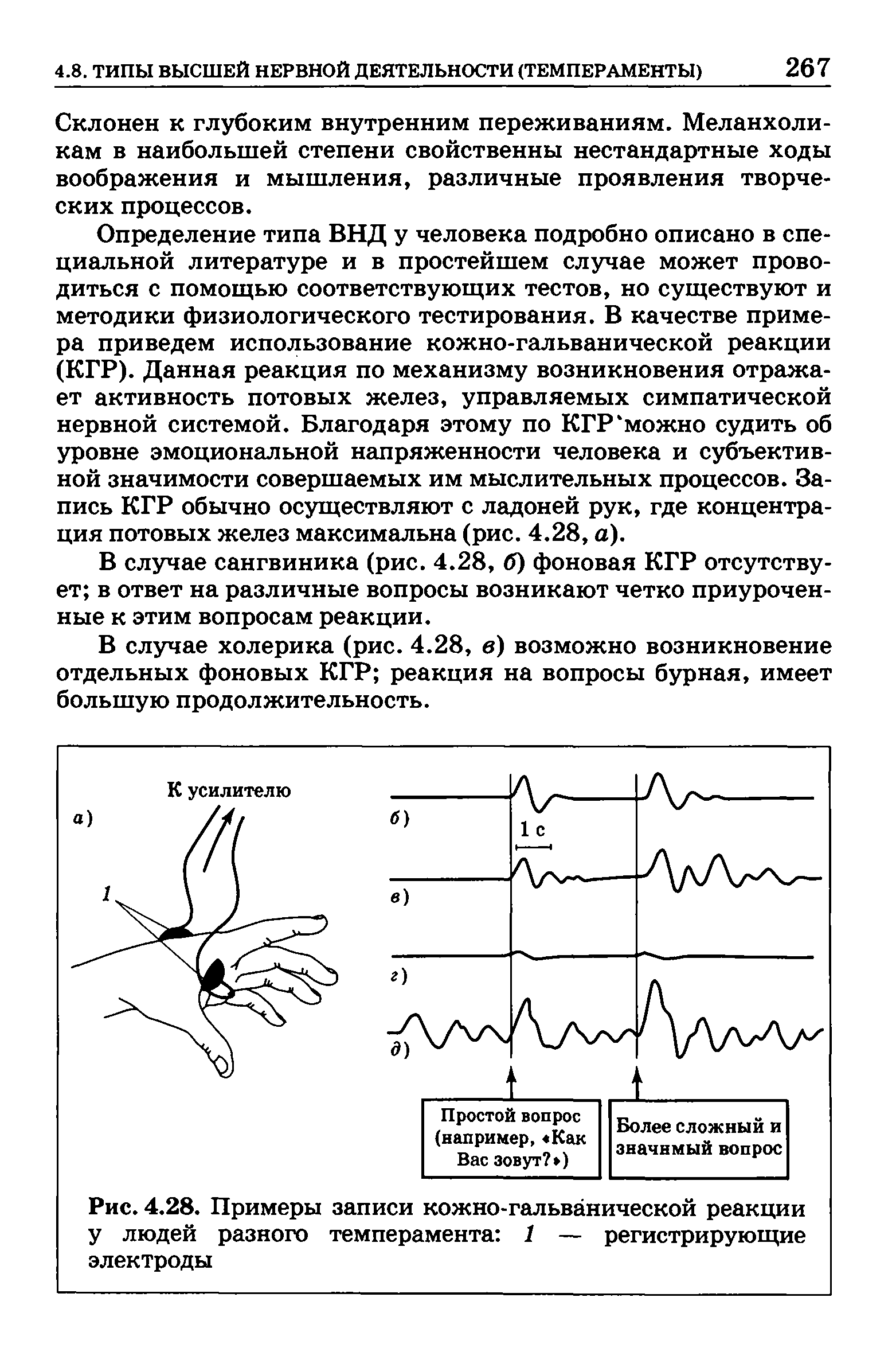 Рис. 4.28. Примеры записи кожно-гальванической реакции у людей разного темперамента 1 — регистрирующие электроды...