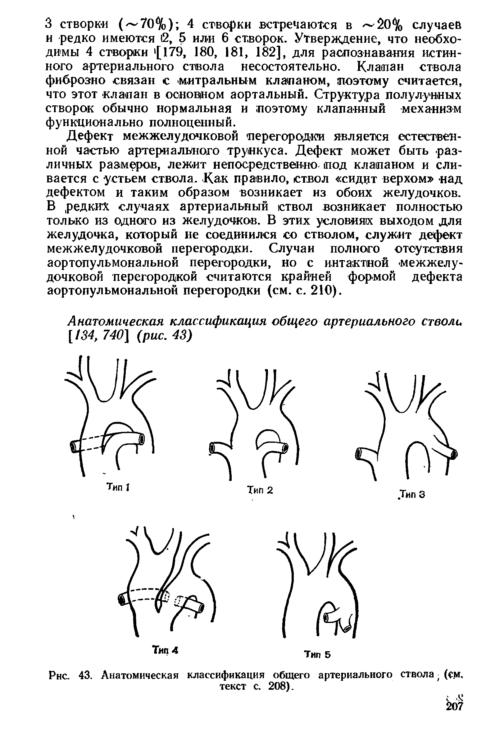 Рис. 43. Анатомическая классификация общего артериального ствола (см, текст с. 208).