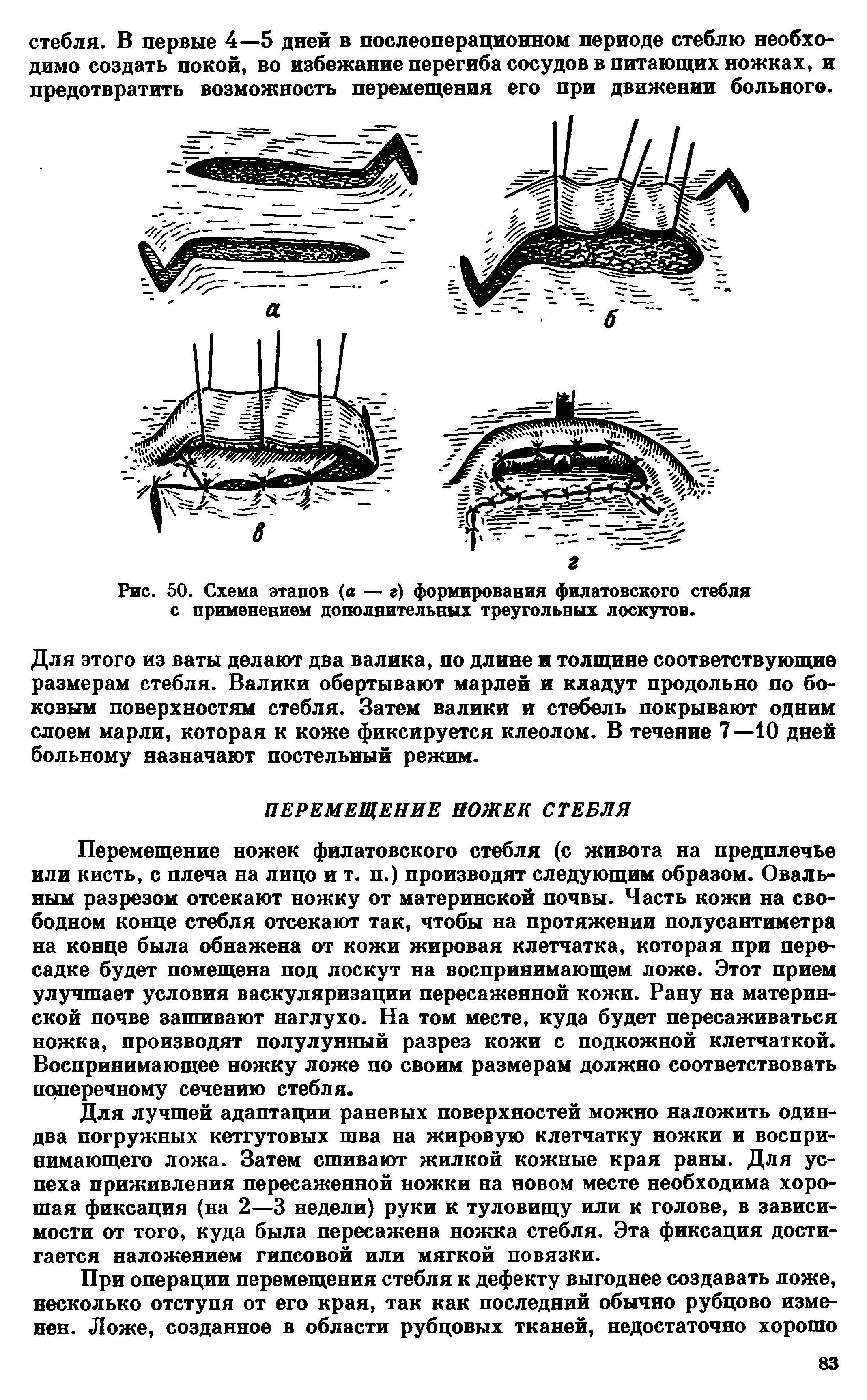 Рис. 50. Схема этапов (а — г) формирования филатовского стебля с применением дополнительных треугольных лоскутов.