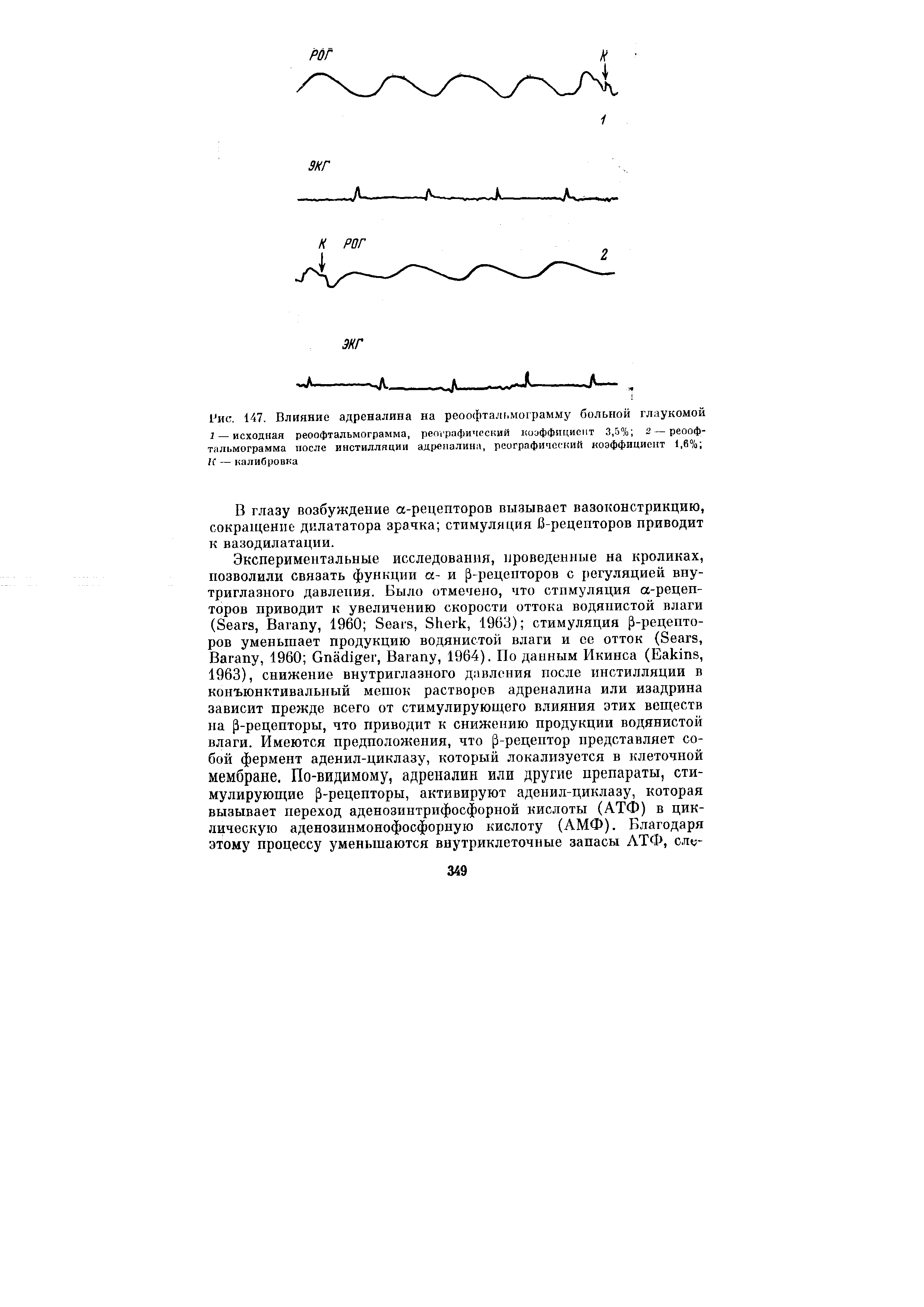 Рис. 147. Влияние адреналина на реоофталг.мограмму больной глаукомой 1— исходная реоофтальмограмма, географический коэффициент 3,5% 2— реооф-...