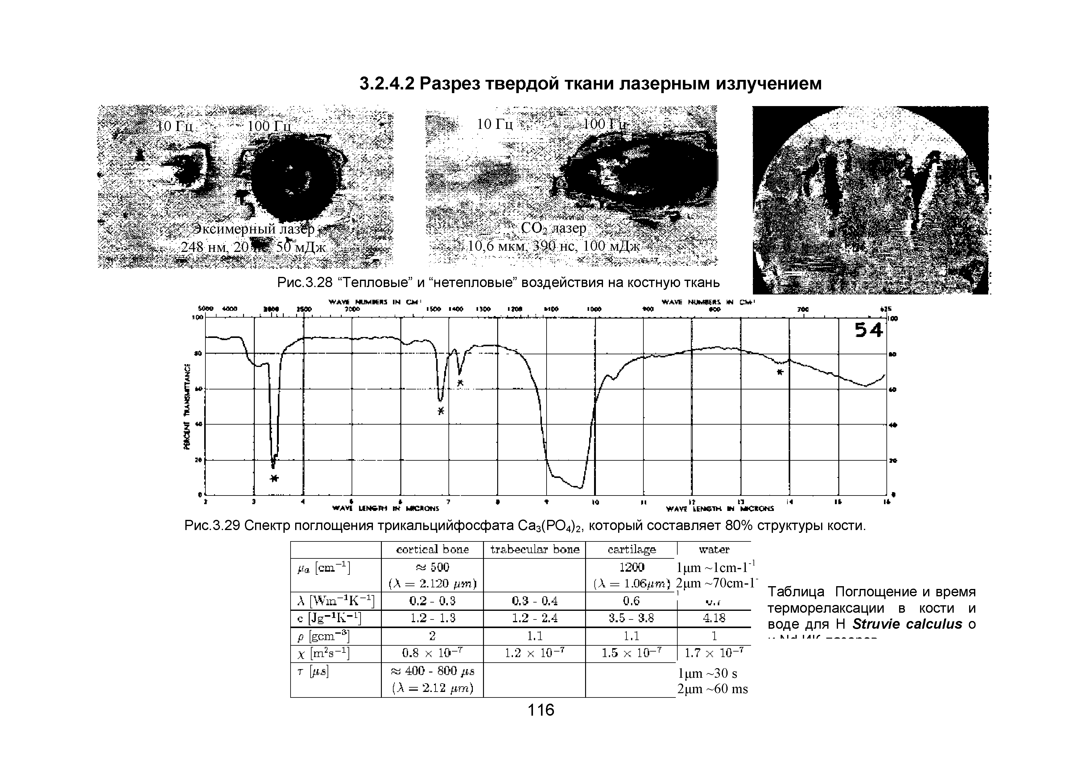 Рис.3.29 Спектр поглощения трикальцийфосфата Са3(РО4)2, который составляет 80% структуры кости.