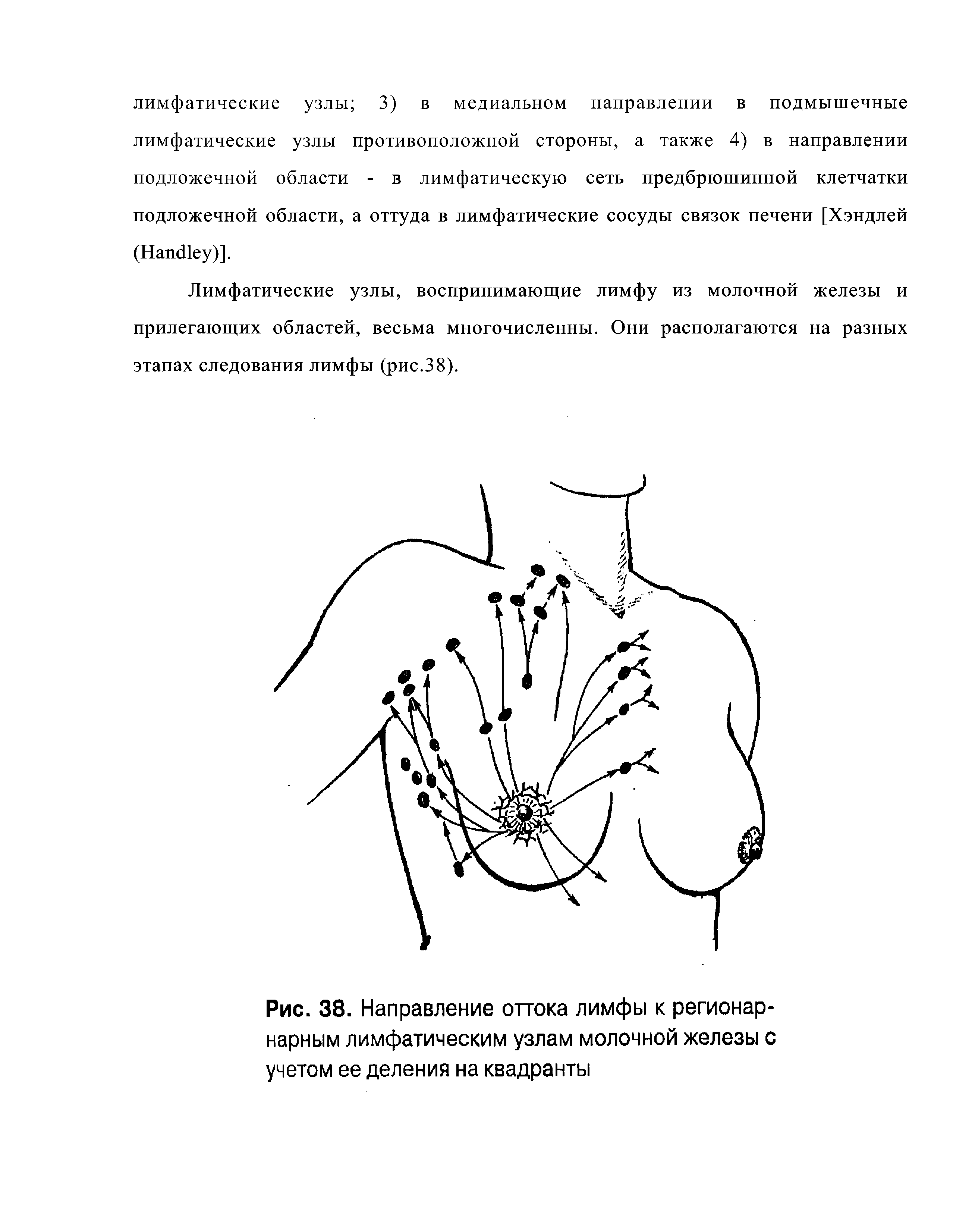 Рис. 38. Направление оттока лимфы к регионар-нарным лимфатическим узлам молочной железы с учетом ее деления на квадранты...