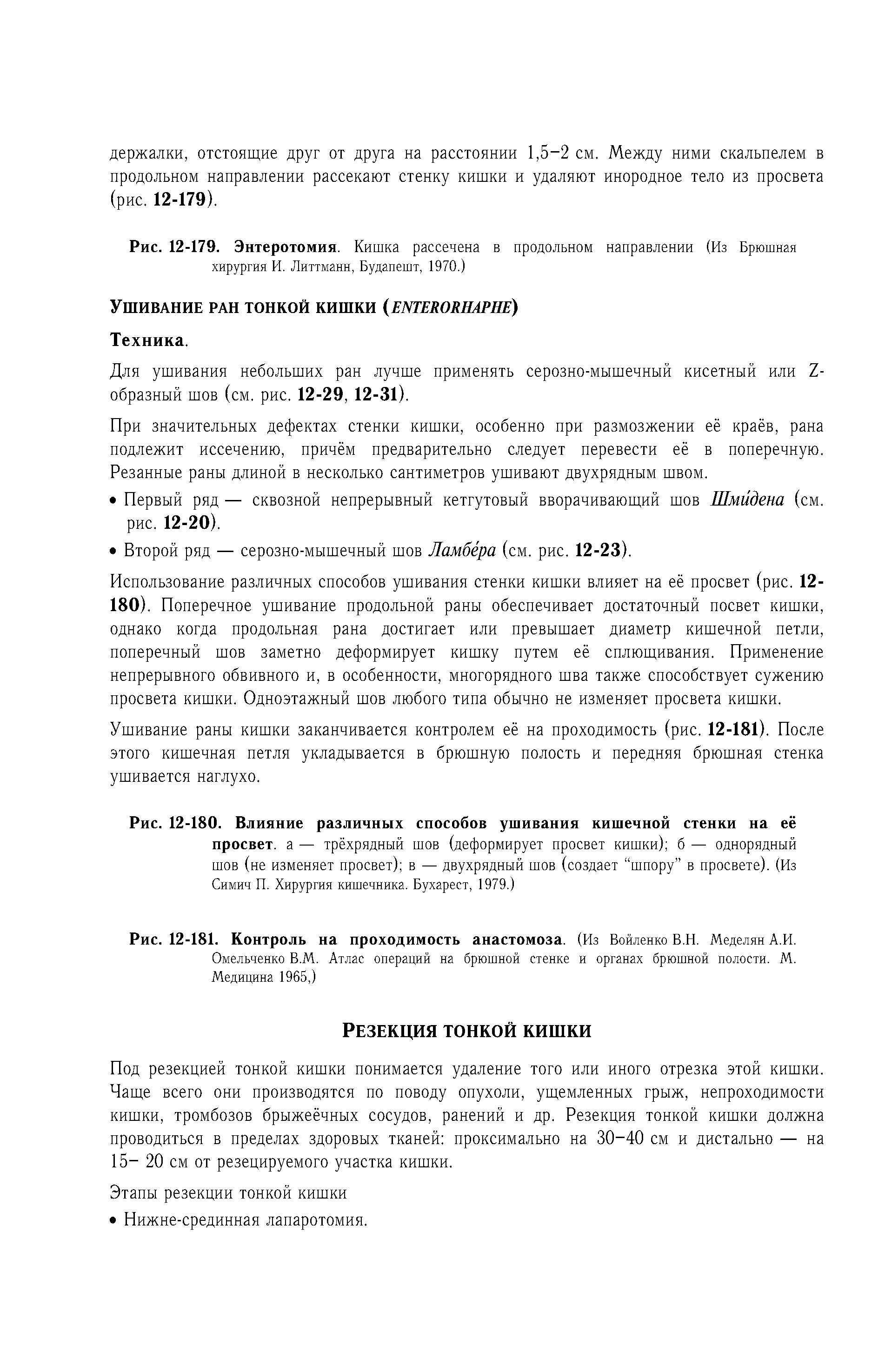 Рис. 12-180. Влияние различных способов ушивания кишечной стенки на её просвет, а — трёхрядный шов (деформирует просвет кишки) б — однорядный шов (не изменяет просвет) в — двухрядный шов (создает шпору в просвете). (Из Симич П. Хирургия кишечника. Бухарест, 1979.)...
