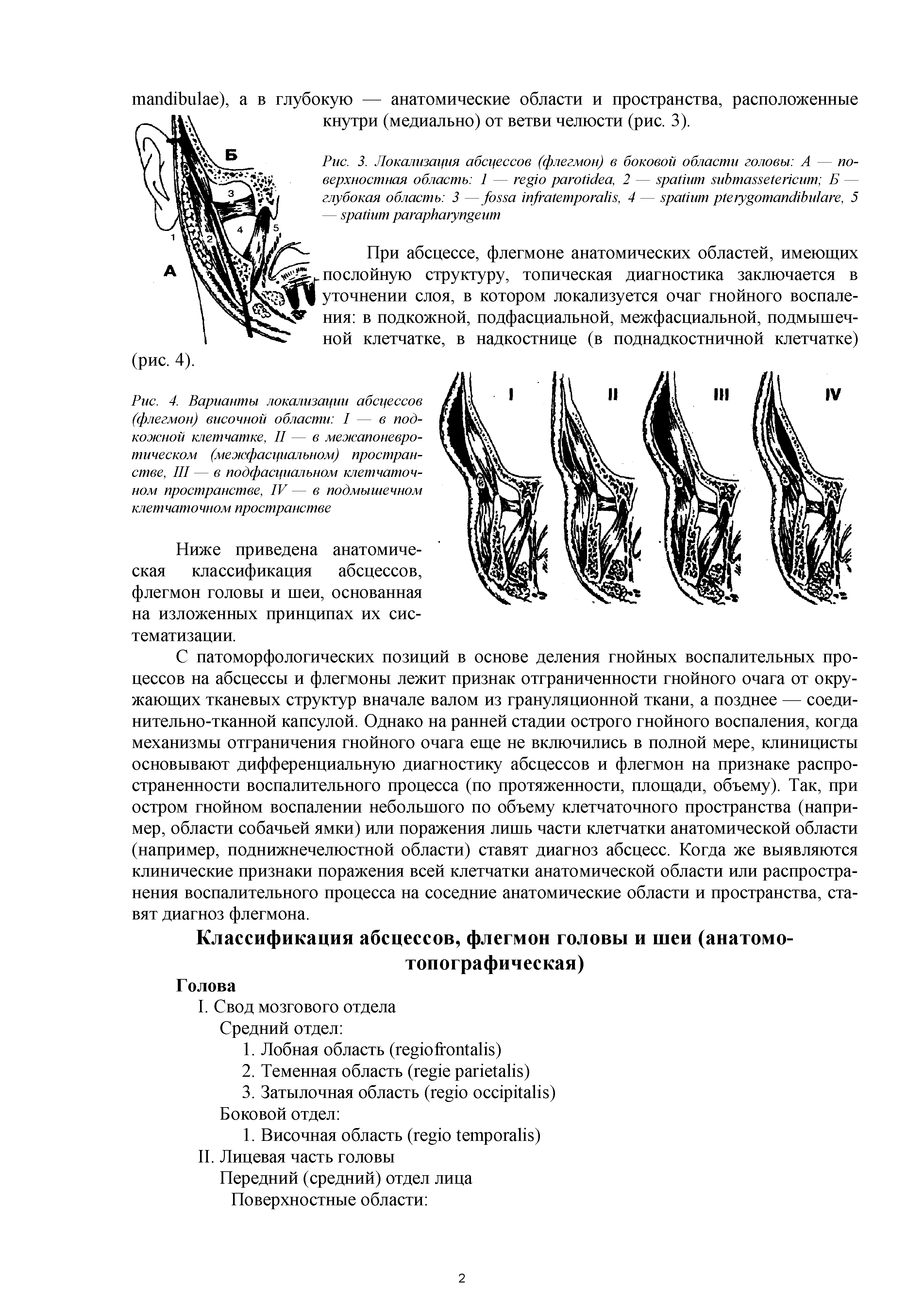 Рис. 4. Варианты локализации абсцессов (флегмон) височной области I — в подкожной клетчатке, II — в межапоневротическом (межфасциалъном) пространстве, III — в подфасциалъном клетчаточ-ном пространстве, IV— в подмышечном клетчаточном пространстве...