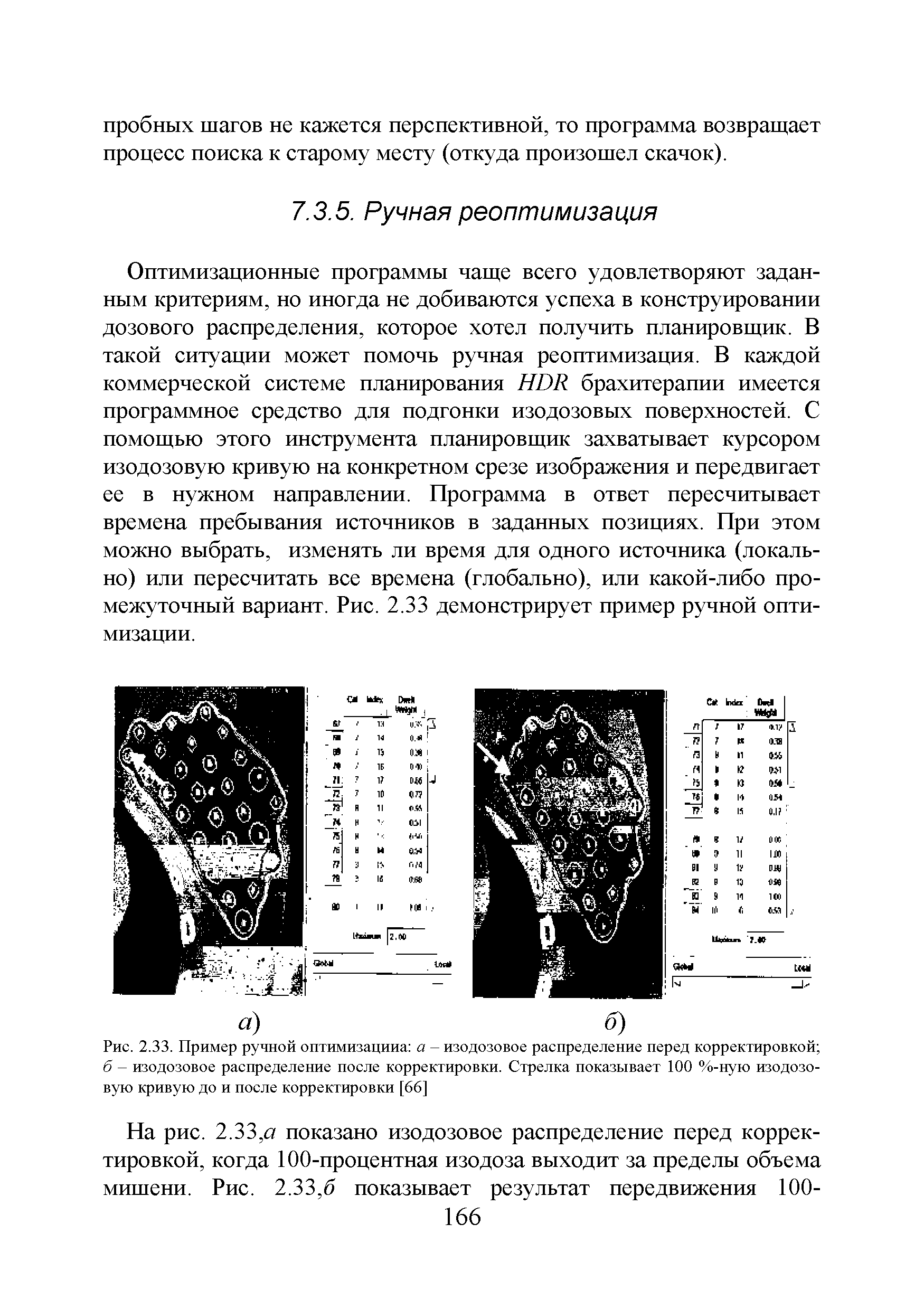 Рис. 2.33. Пример ручной оптимизацииа а - изодозовое распределение перед корректировкой б - изодозовое распределение после корректировки. Стрелка показывает 100 %-ную изодозовую кривую до и после корректировки [66]...