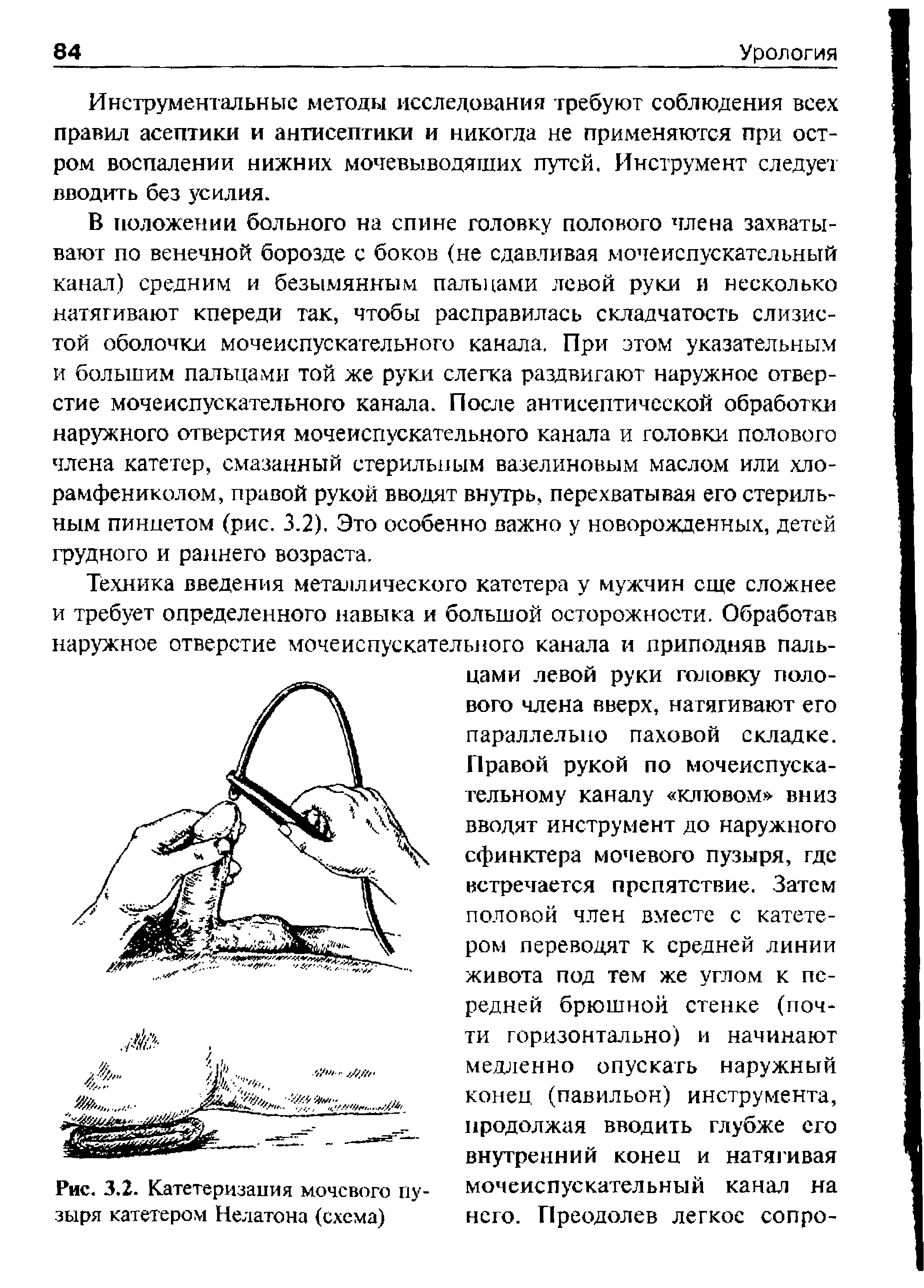 Рис. 3.2. Катетеризация мочевого пузыря катетером Нелатона (схема)...