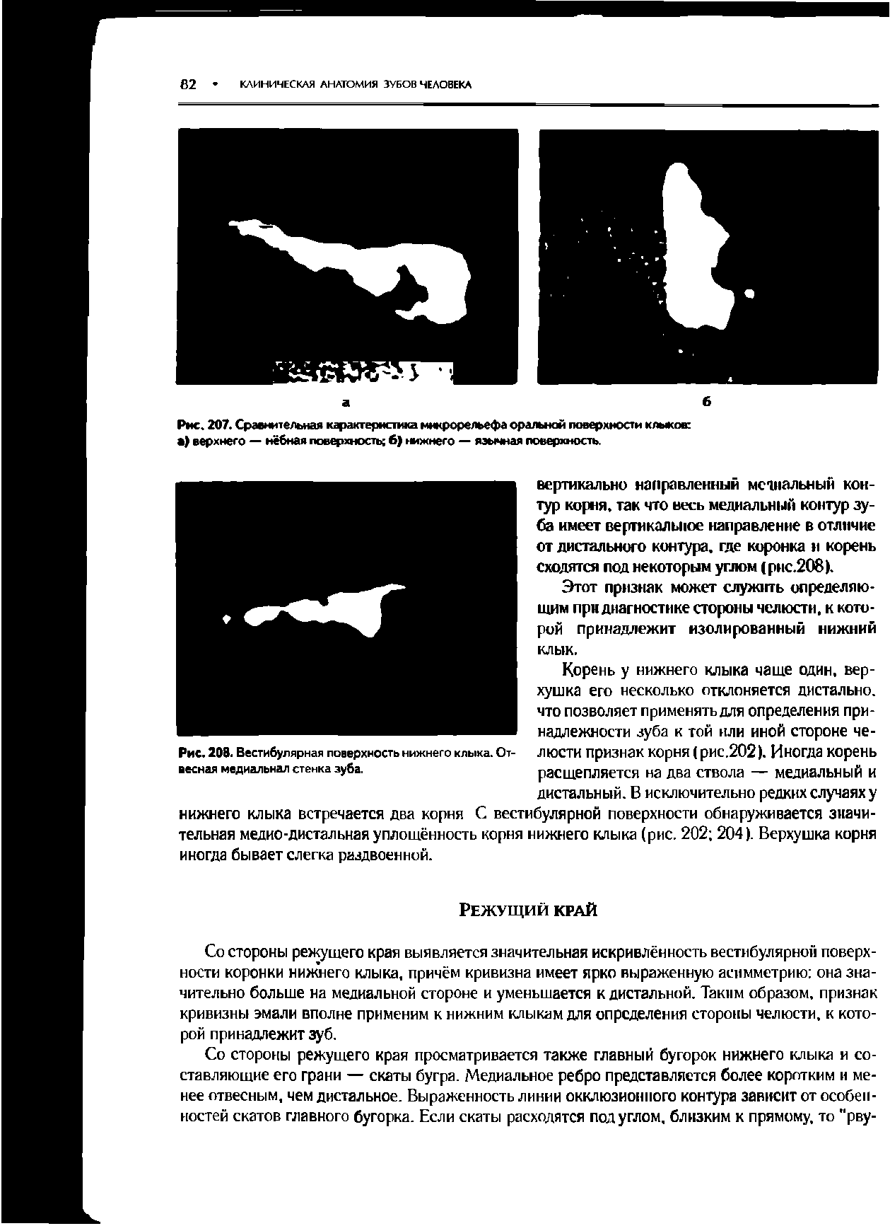 Рис. 207. Сравнительная характеристика микрорельефа оральной поверхности клмиж а) верхнего — нёбная поверхность 6) нижнего — язычная поверхность.