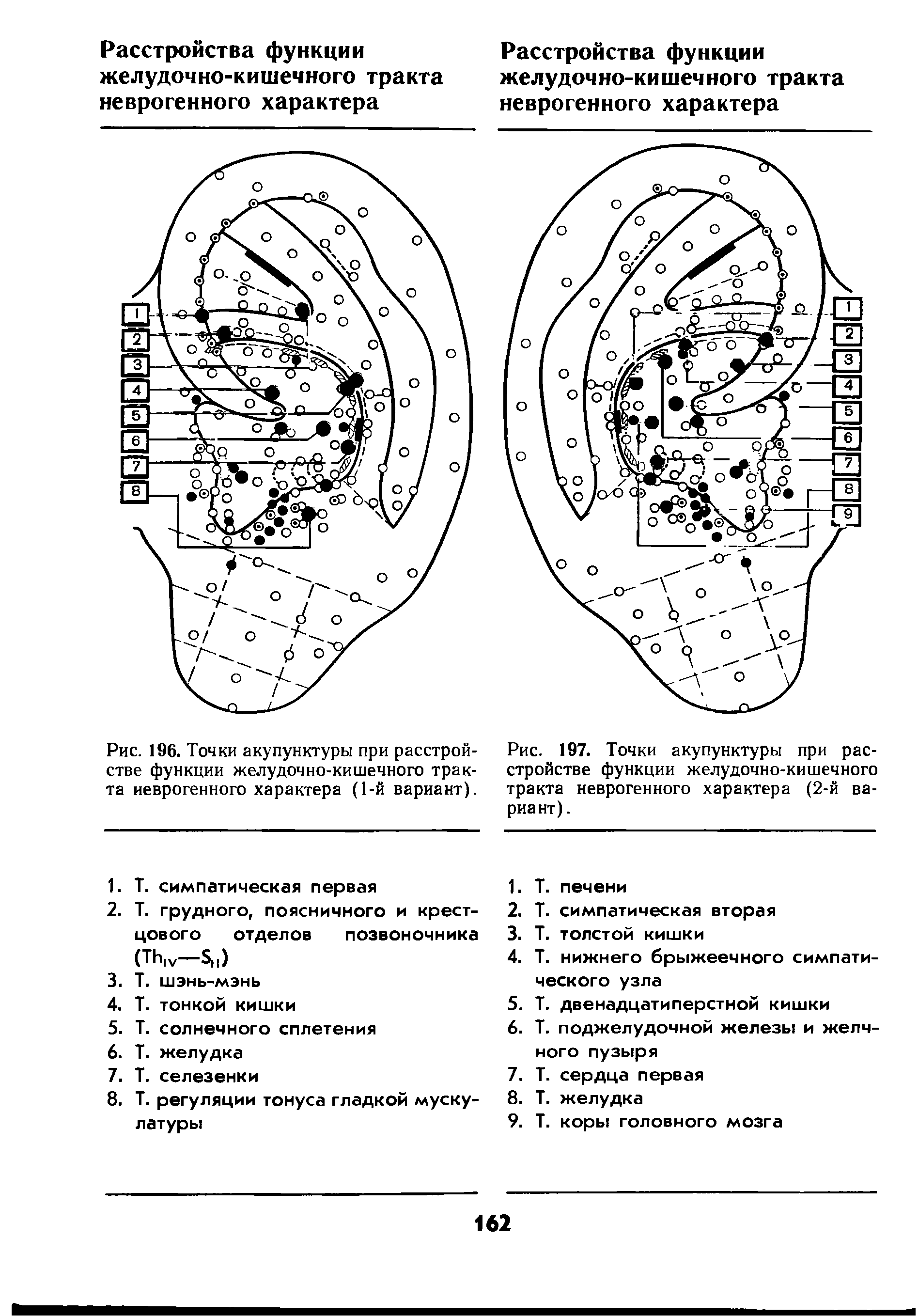 Рис. 197. Точки акупунктуры при расстройстве функции желудочно-кишечного тракта неврогенного характера (2-й вариант). ...