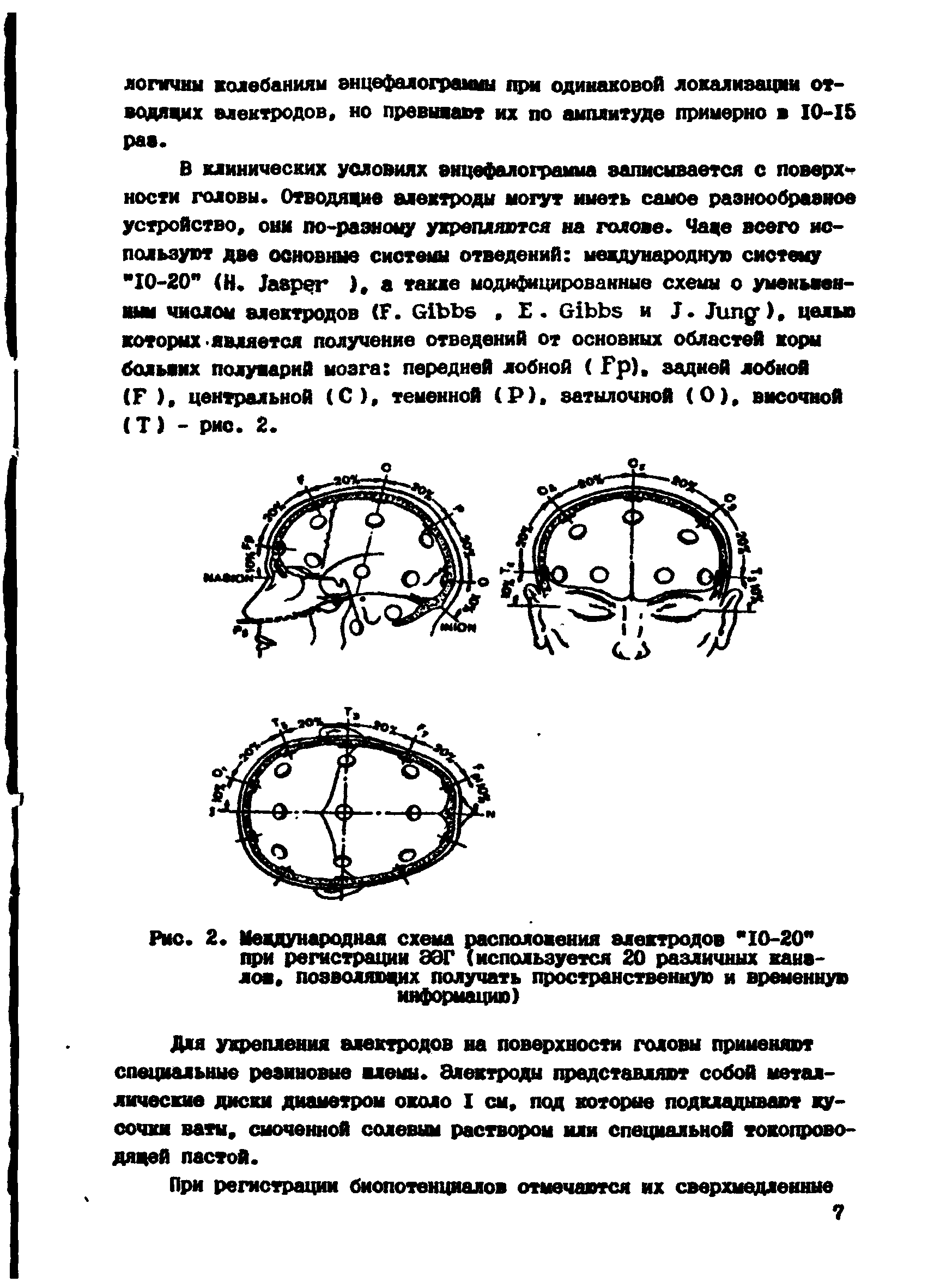 Рис. 2. Международная схема расположения электродов "10-20" при регистрации ЭЭГ (используется 20 различных каналов. позволяющих получать пространственную и временную информацию)...