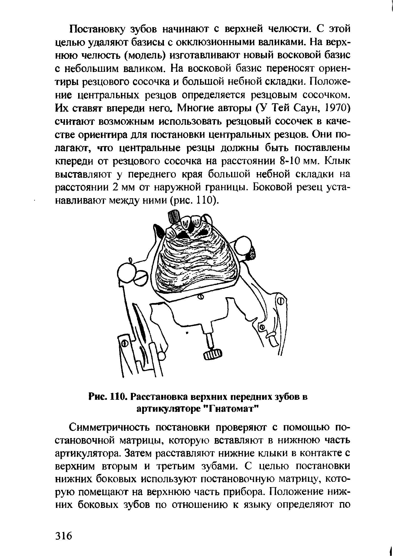 Рис. 110. Расстановка верхних передних зубов в артикуляторе "Гнатомат"...