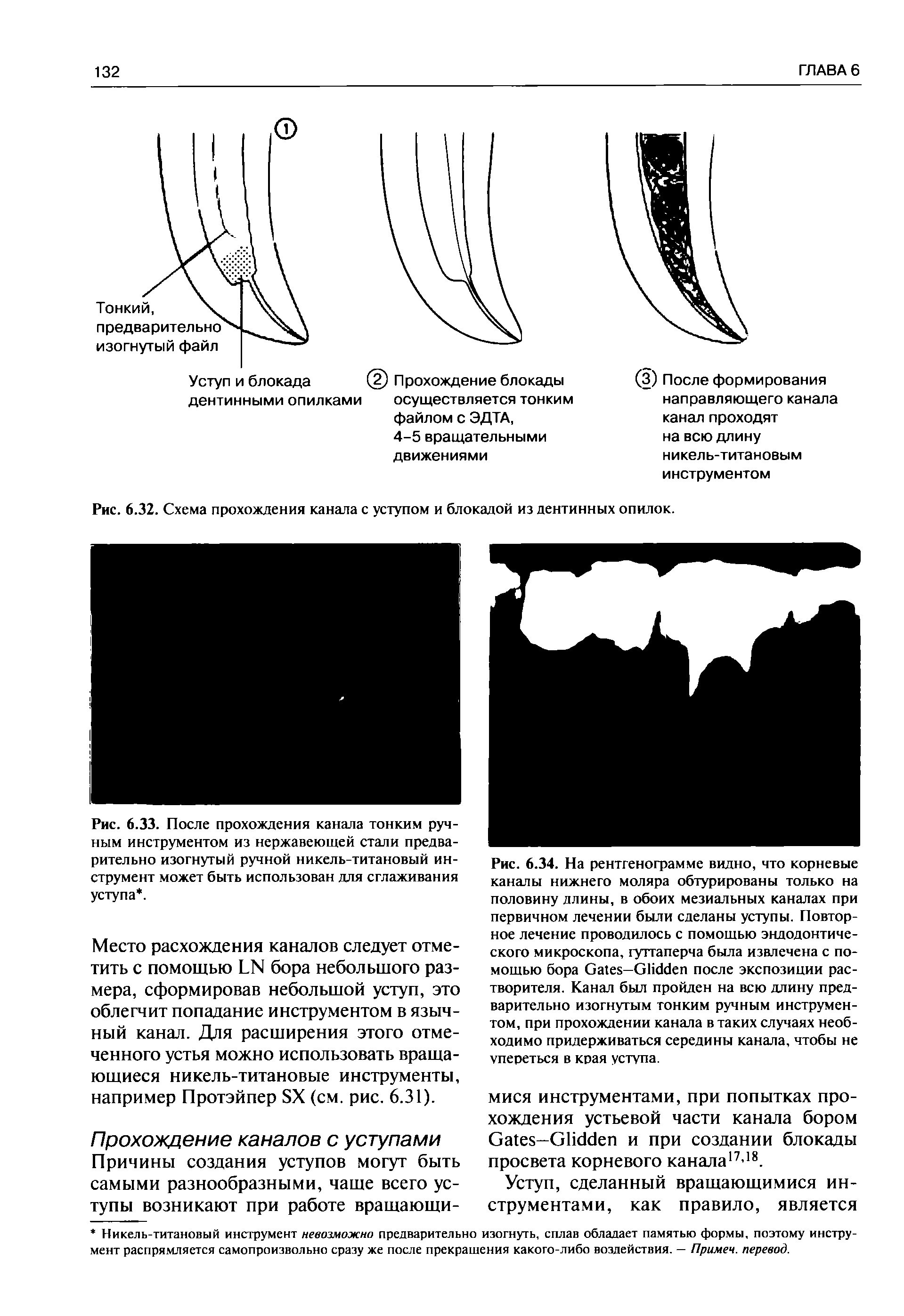 Рис. 6.33. После прохождения канала тонким ручным инструментом из нержавеющей стали предварительно изогнутый ручной никель-титановый инструмент может быть использован для сглаживания уступа. ...