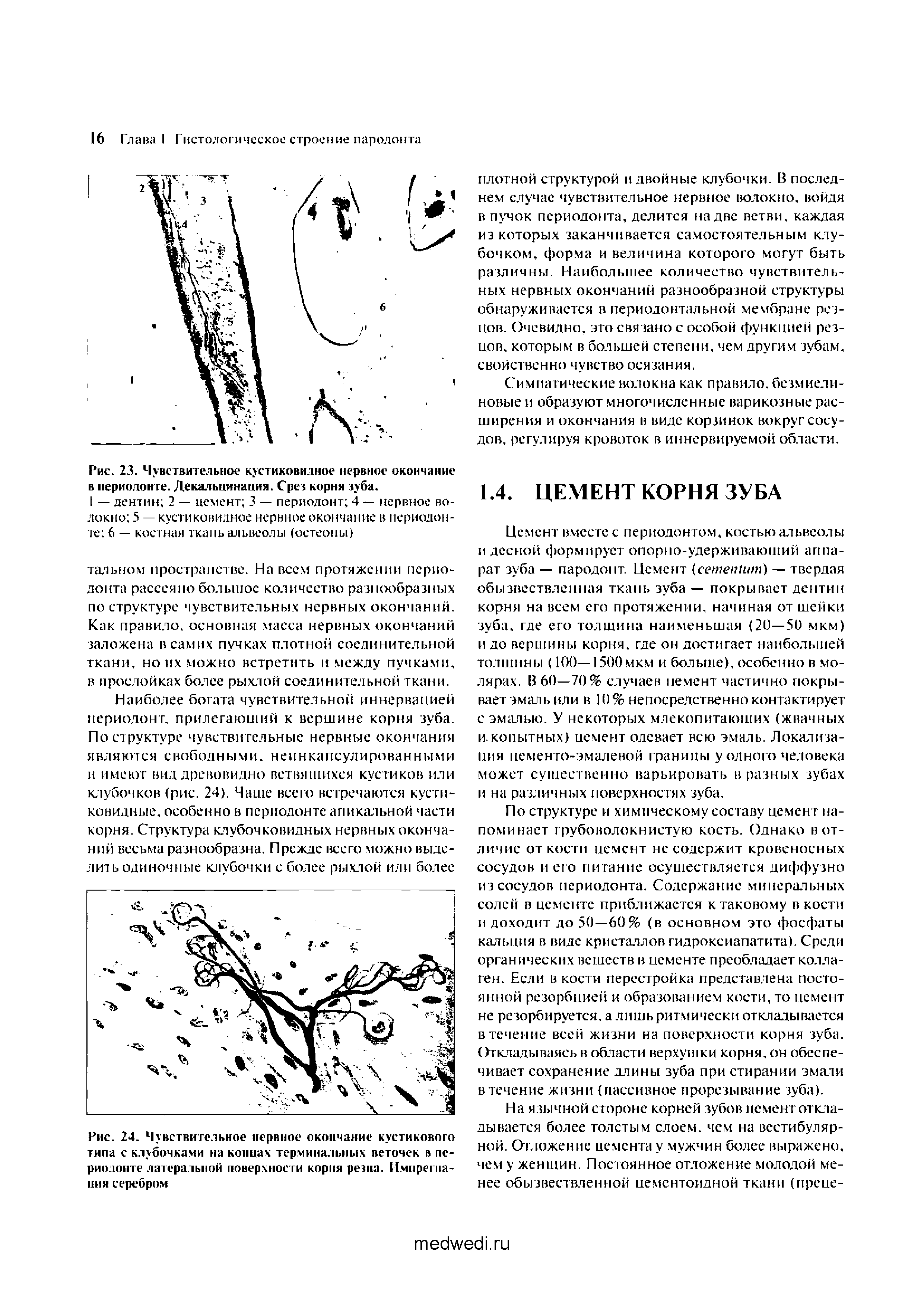 Рис. 23. Чувствительное кустиковидное нервное окончание в периодонте. Декальцинация. Срез корня зуба.