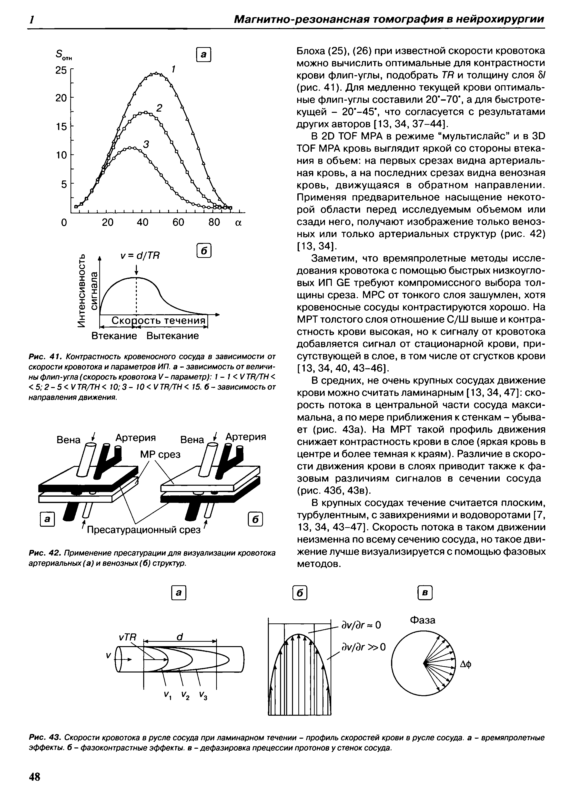 Рис. 43. Скорости кровотока в русле сосуда при ламинарном течении - профиль скоростей крови в русле сосуда, а - времяпролетные эффекты. 6 - фазоконтрастные эффекты, в - дефазировка прецессии протонов у стенок сосуда.