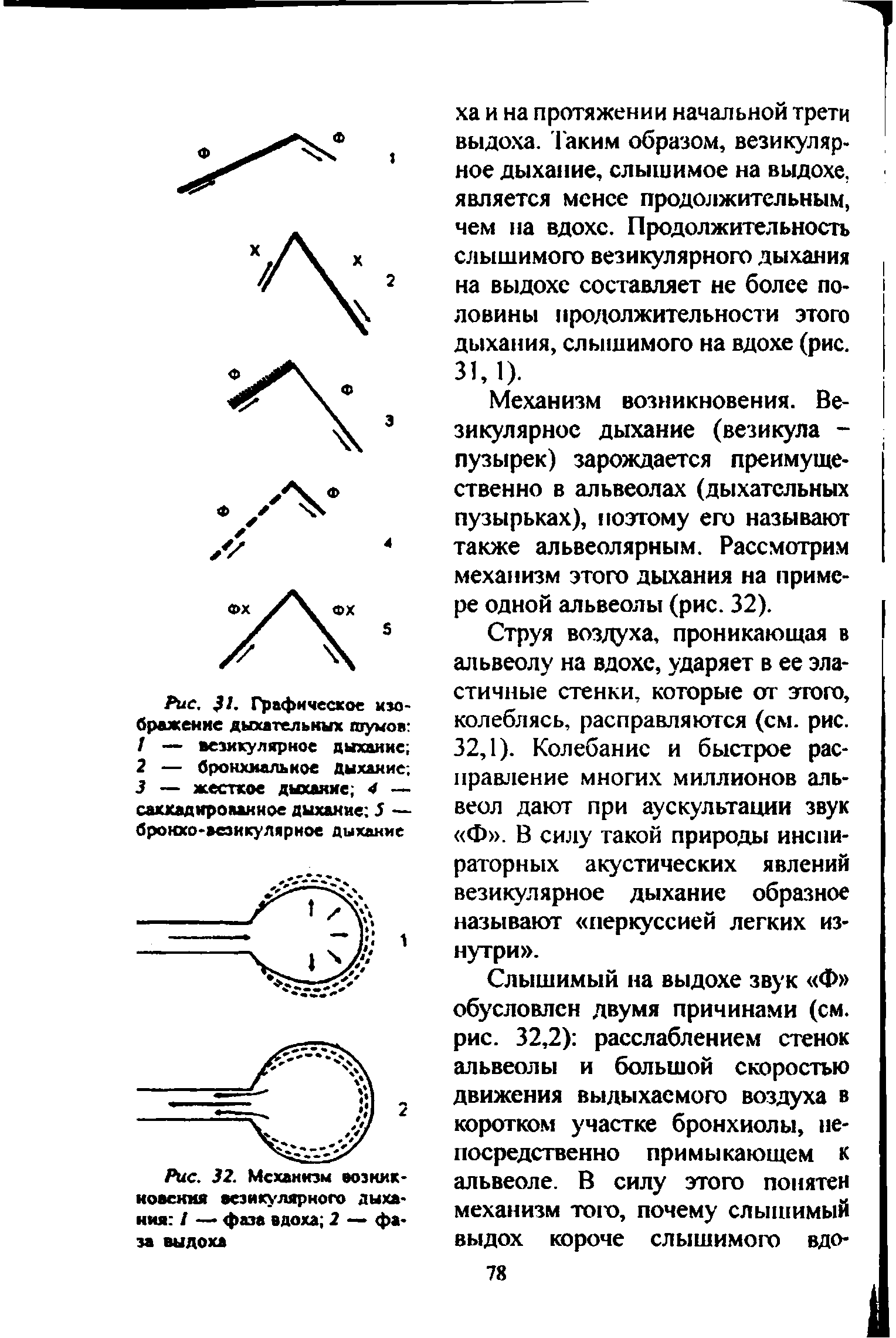 Рис. 32. Механизм возникновения везикулярного дыхания / — фаза вдоха 2 — фаза выдоха...