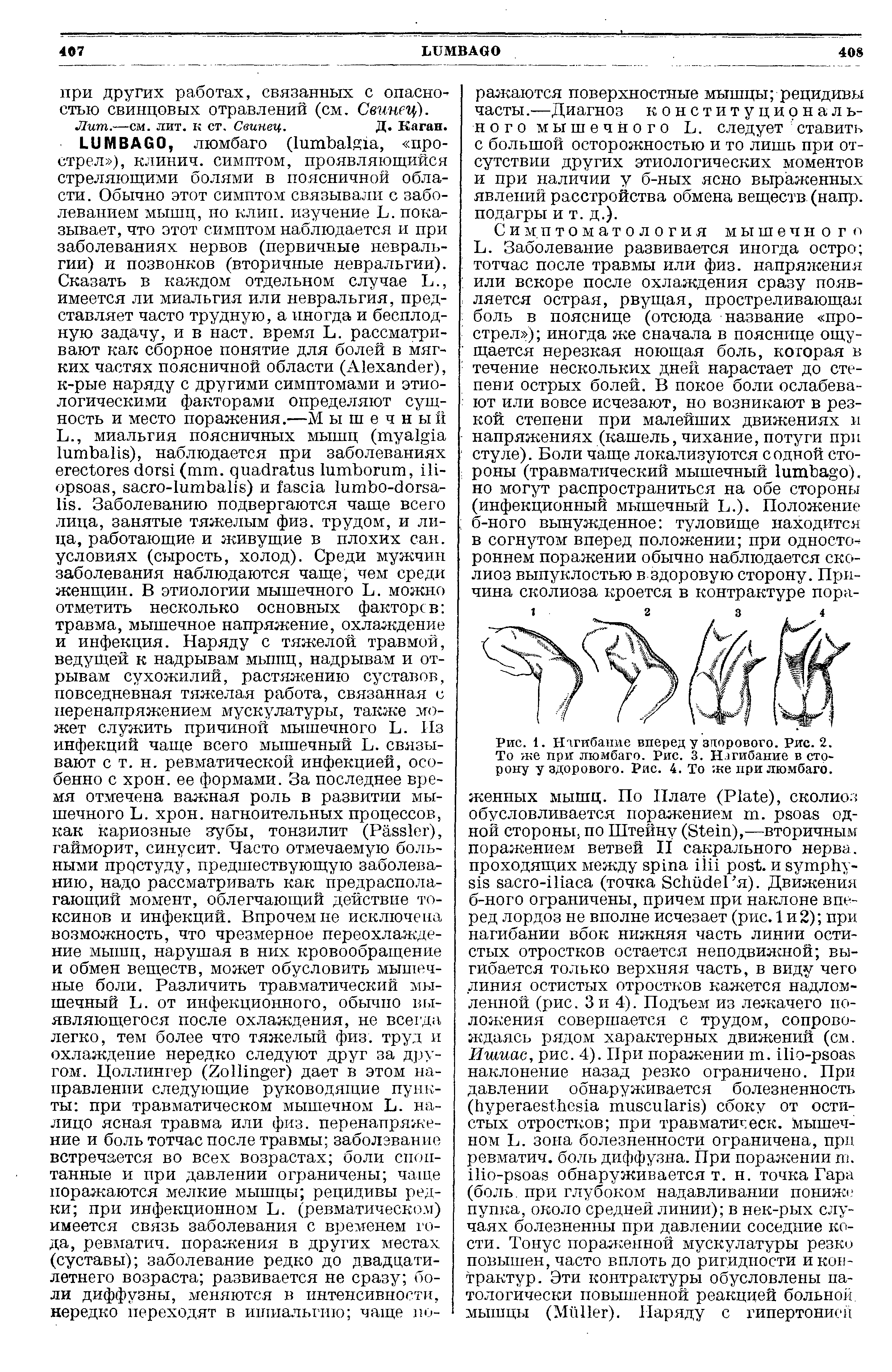 Рис. 1. Изгибание вперед у здорового. Рис. 2. То же при люмбаго. Рис. 3. Нагибание в сторону у здорового. Рис. 4. То же при люмбаго.