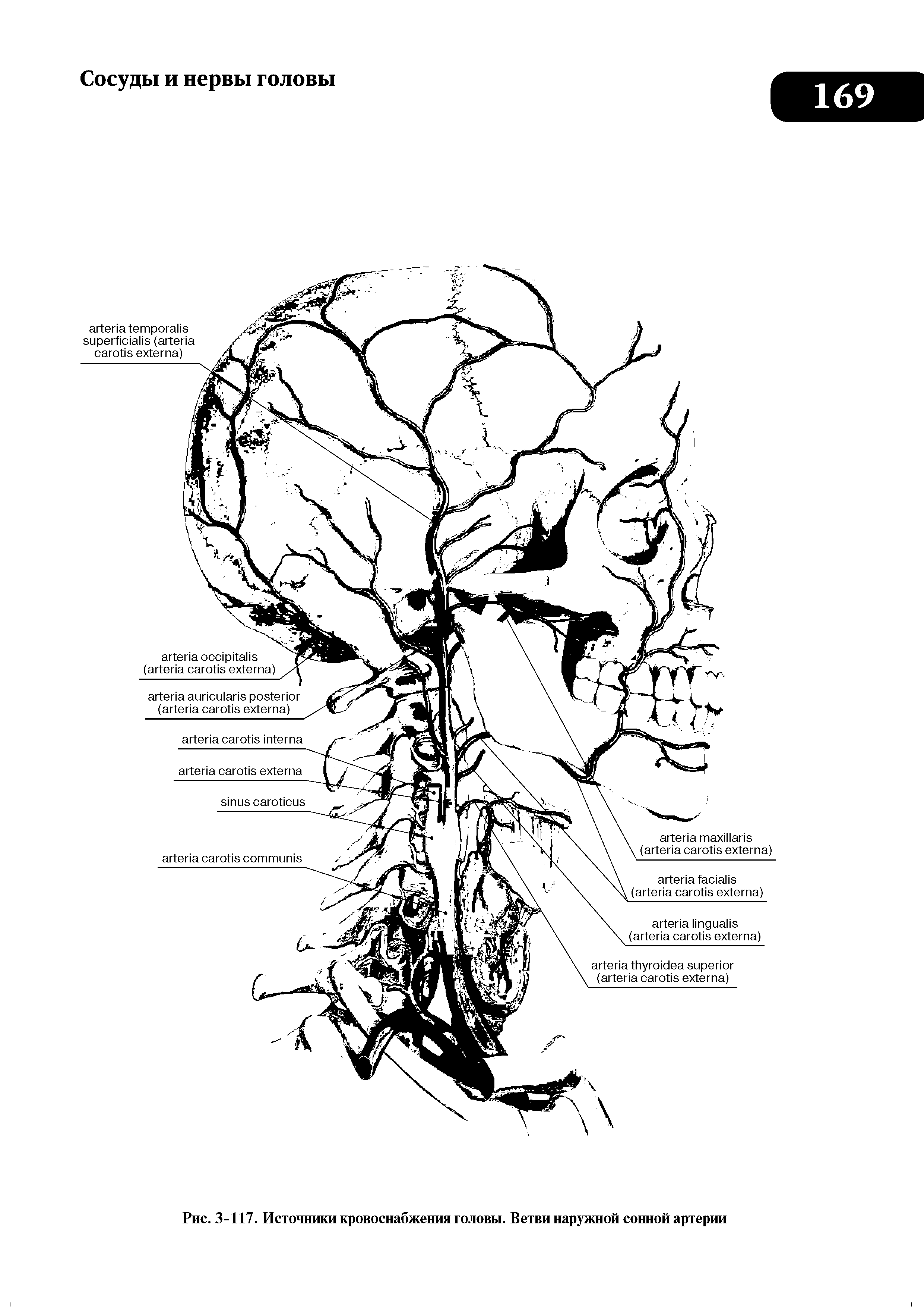 Рис. 3-117. Источники кровоснабжения головы. Ветви наружной сонной артерии...