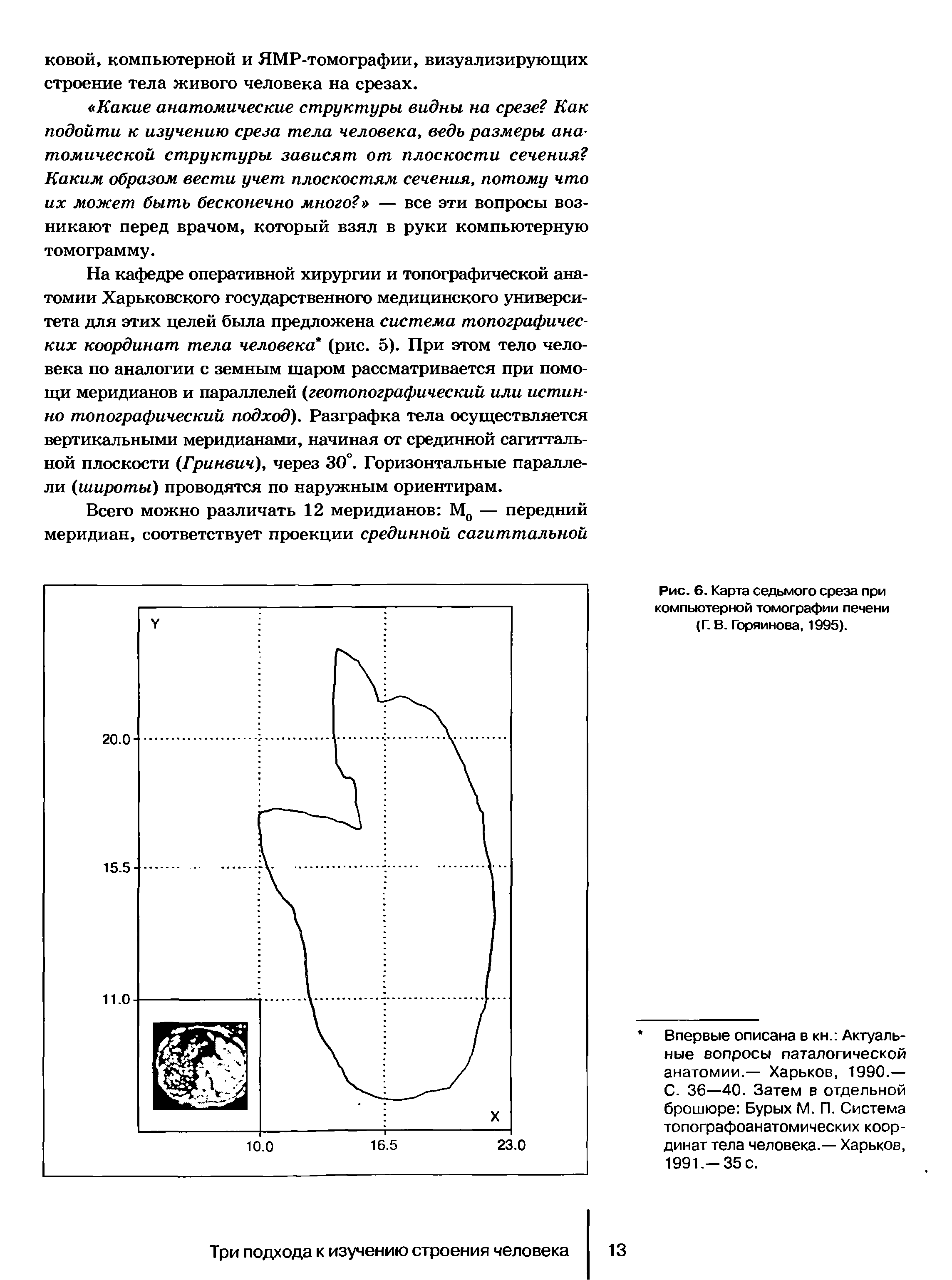 Рис. 6. Карта седьмого среза при компьютерной томографии печени (Г. В. Горяйнова, 1995).