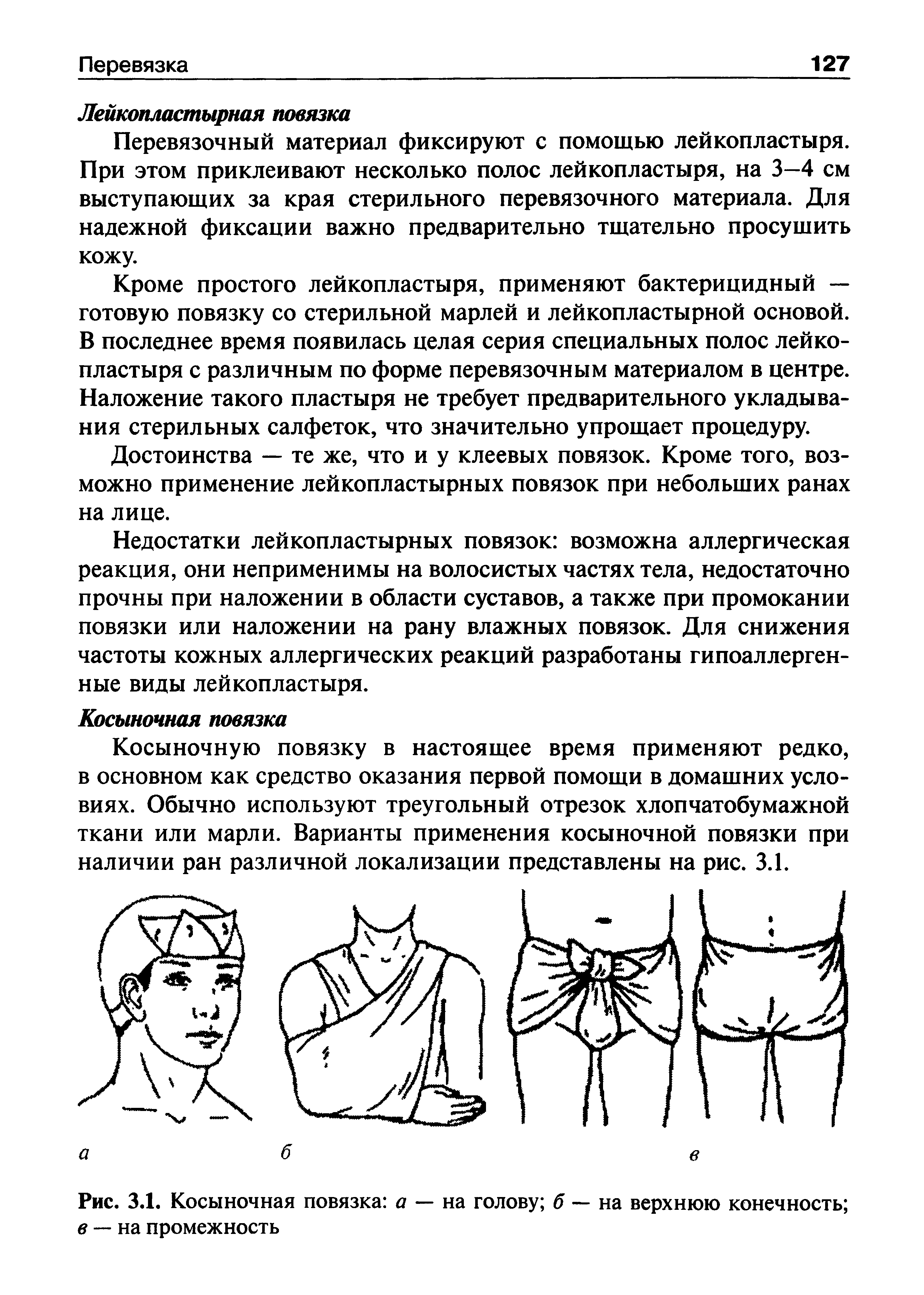 Рис. 3.1. Косыночная повязка а — на голову б — на верхнюю конечность в — на промежность...