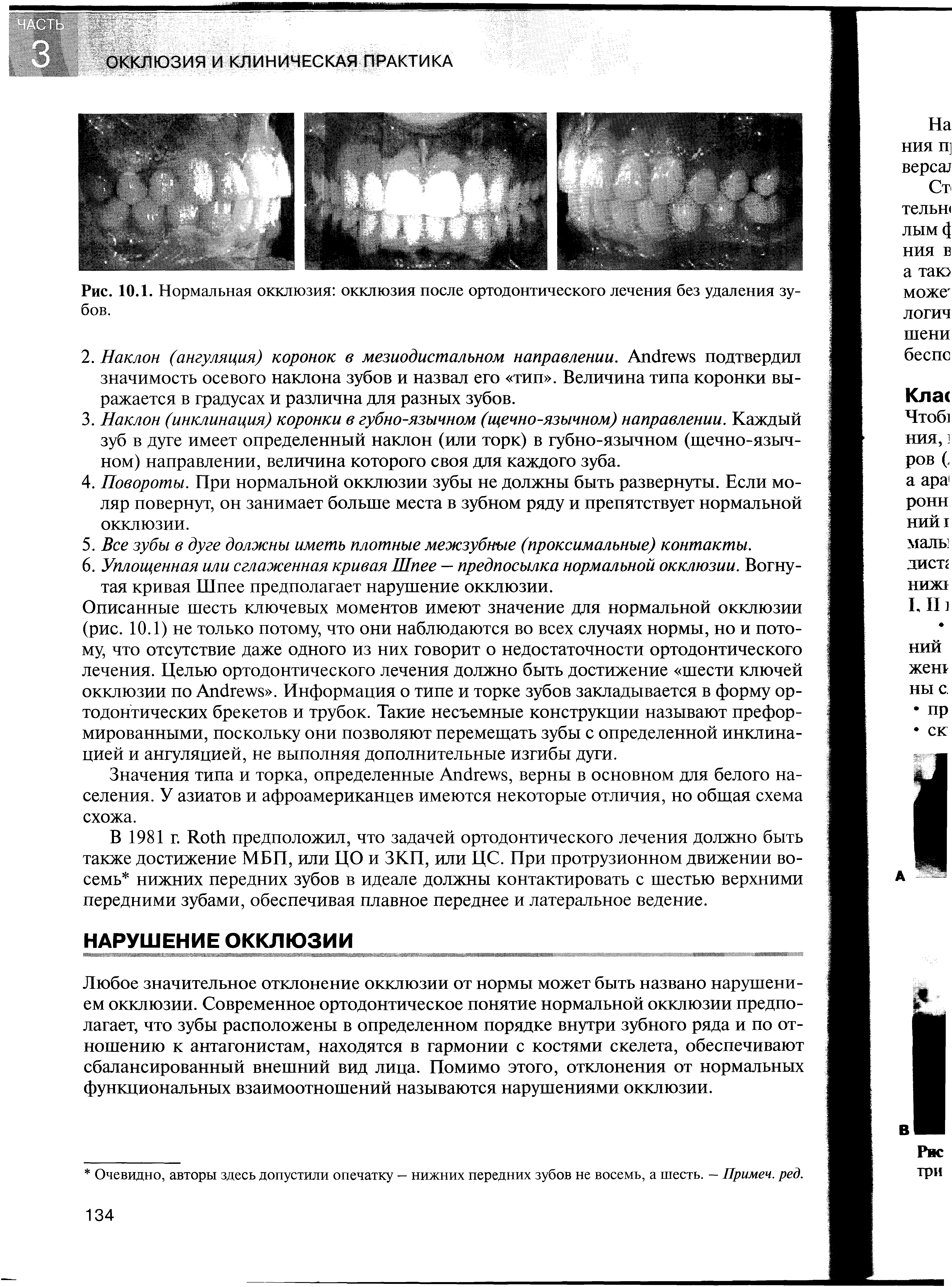 Рис. 10.1. Нормальная окклюзия окклюзия после ортодонтического лечения без удаления зубов.