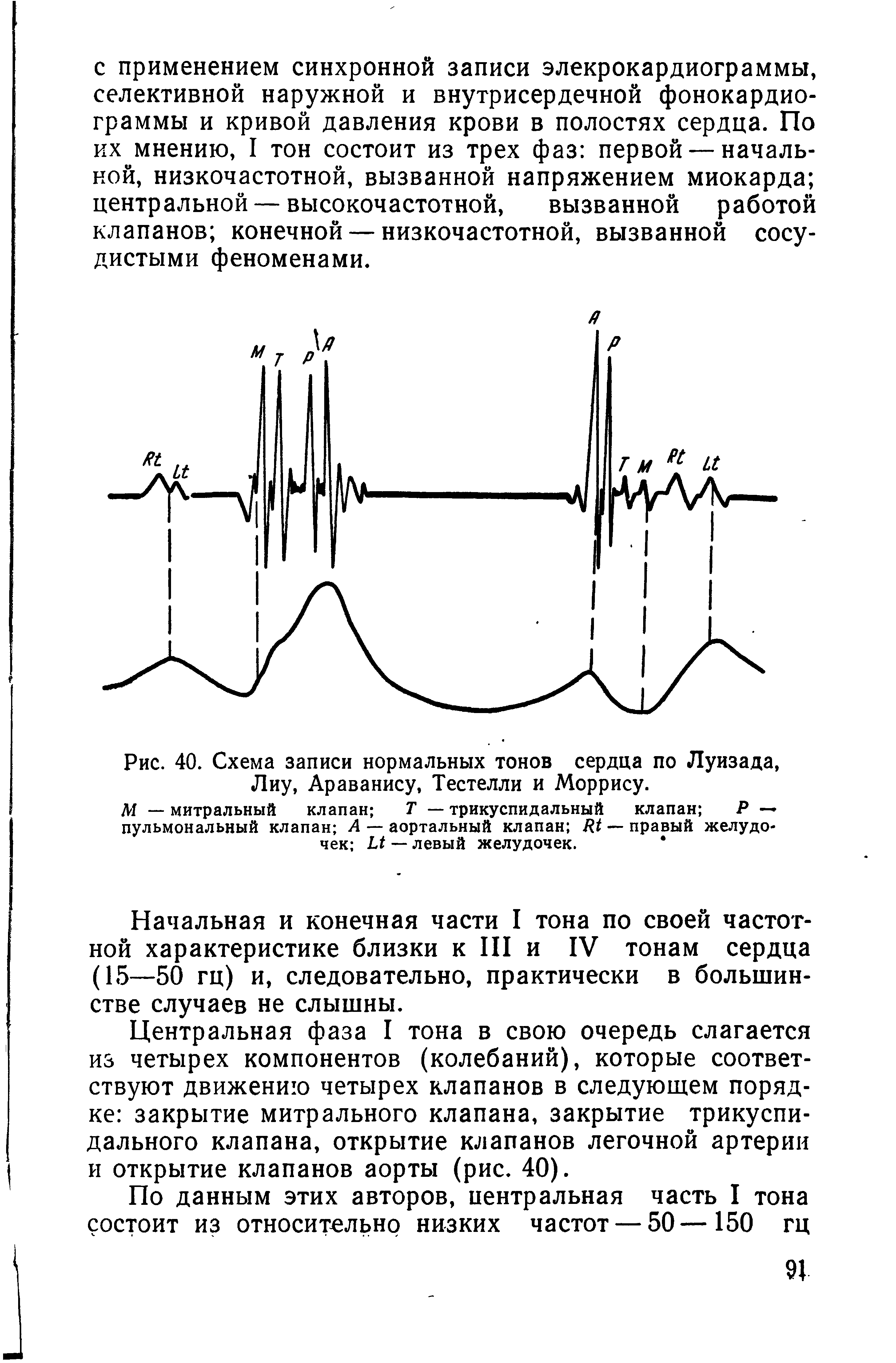 Рис. 40. Схема записи нормальных тонов сердца по Луизада, Лиу, Араванису, Тестелли и Моррису.