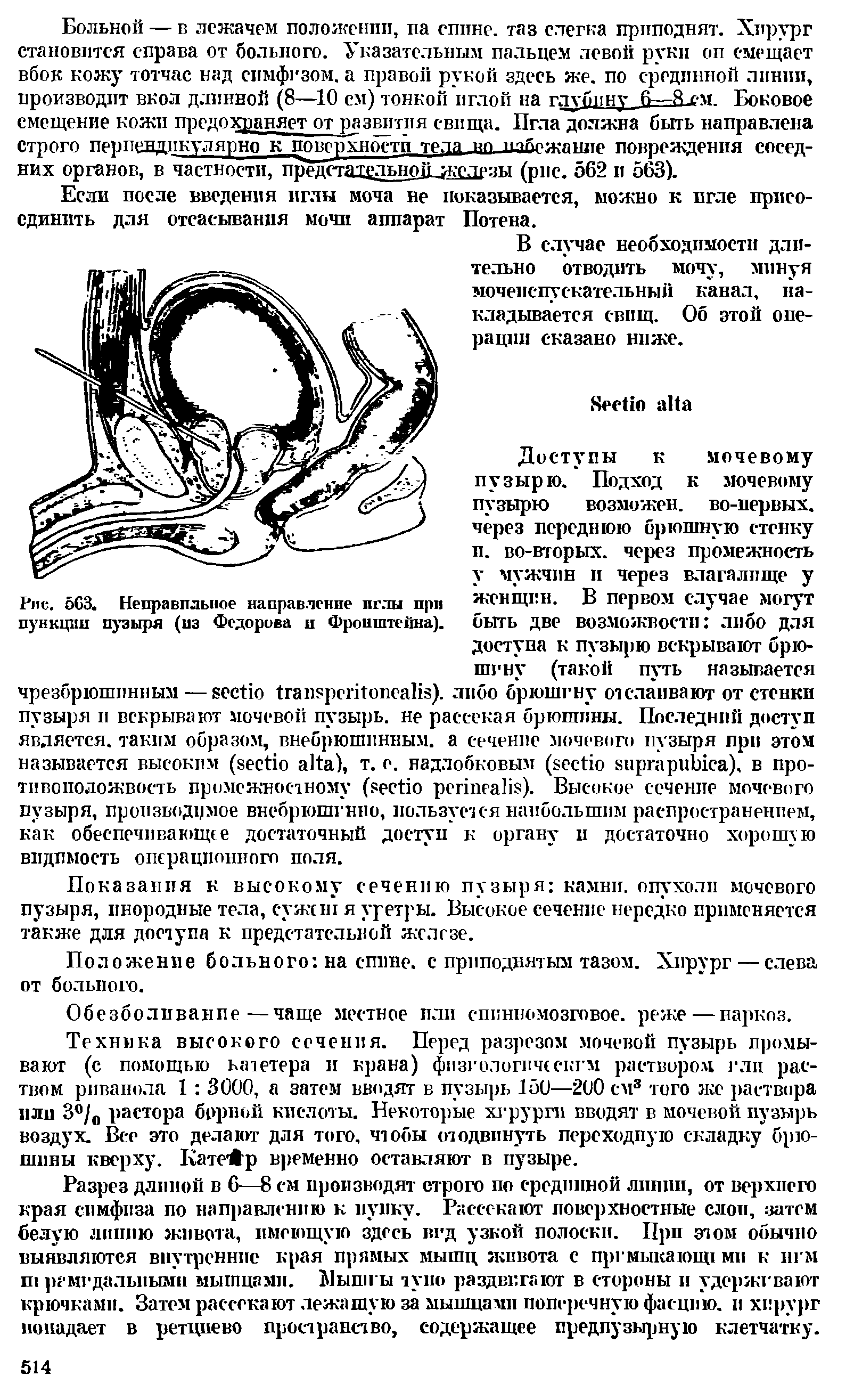 Рис. 563. Неправильное направление иглы при пункции пузыря (из Федорова и Фронштепна).