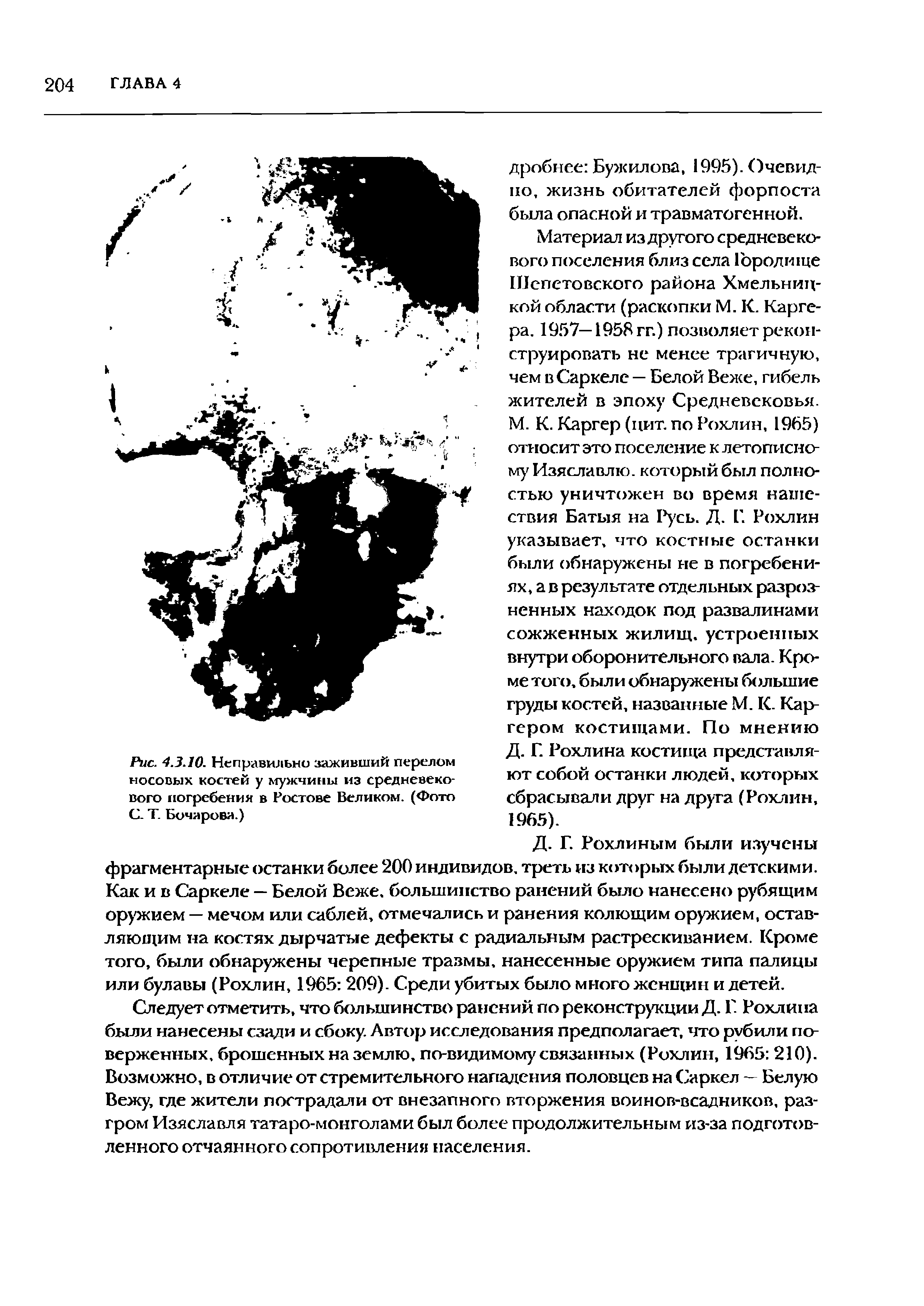 Рис. 4.3.10. Неправильно заживший перелом носовых костей у мужчины из средневекового погребения в Ростове Великом. (Фото С. Т. Бочарова.)...