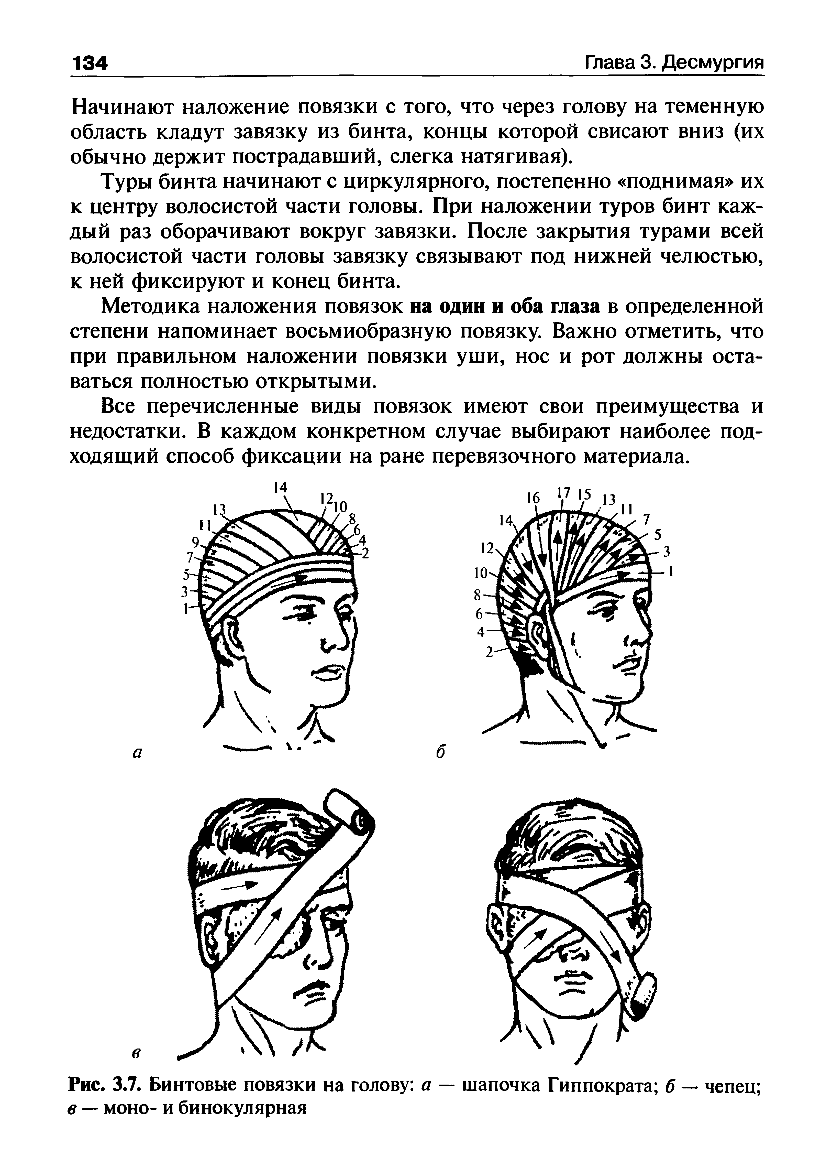 Рис. 3.7. Бинтовые повязки на голову а — шапочка Гиппократа б — чепец в — моно- и бинокулярная...
