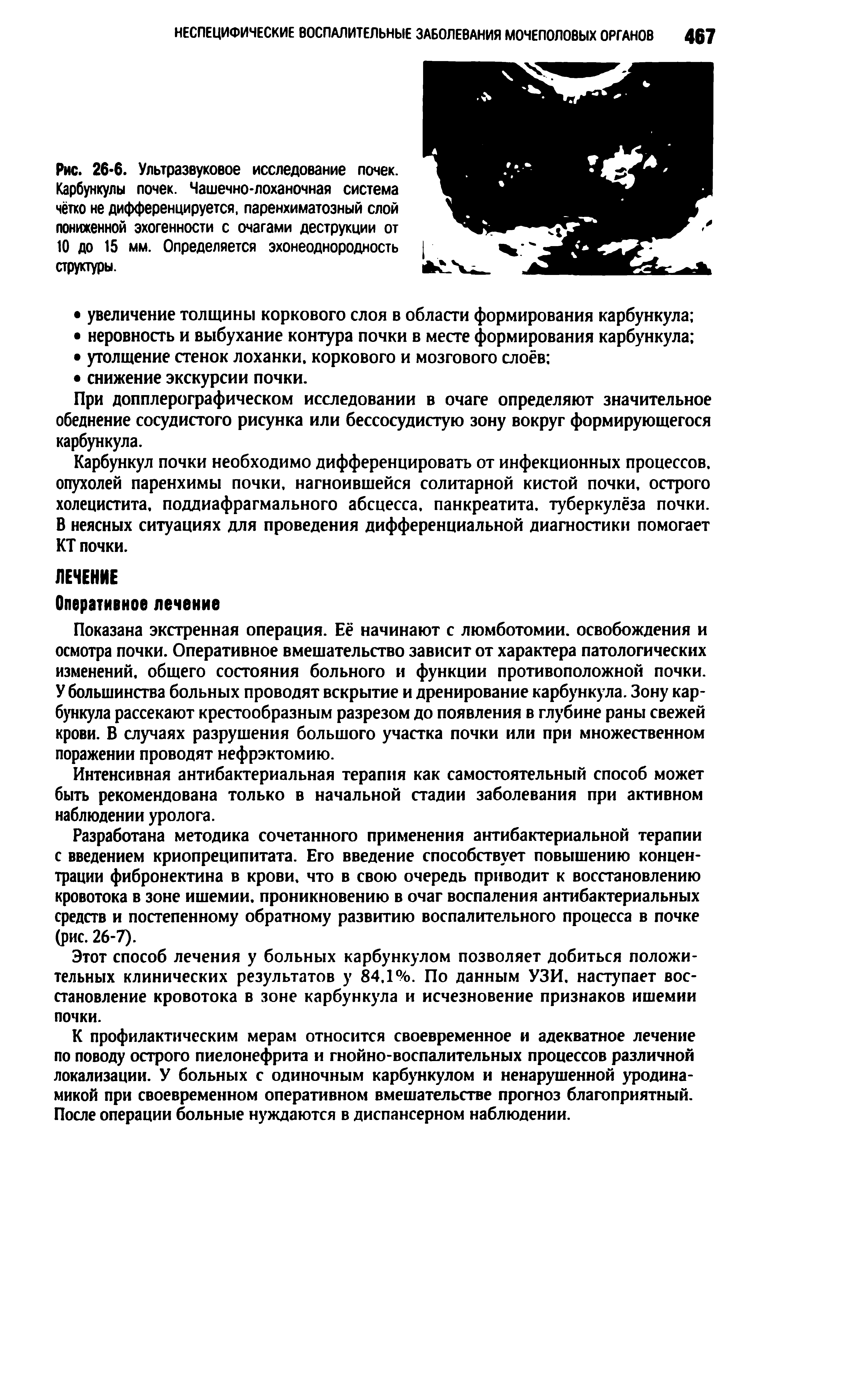 Рис. 26-6. Ультразвуковое исследование почек. Карбункулы почек. Чашечно-лоханочная система чётко не дифференцируется, паренхиматозный слой пониженной эхогенности с очагами деструкции от 10 до 15 мм. Определяется эхонеоднородность структуры.