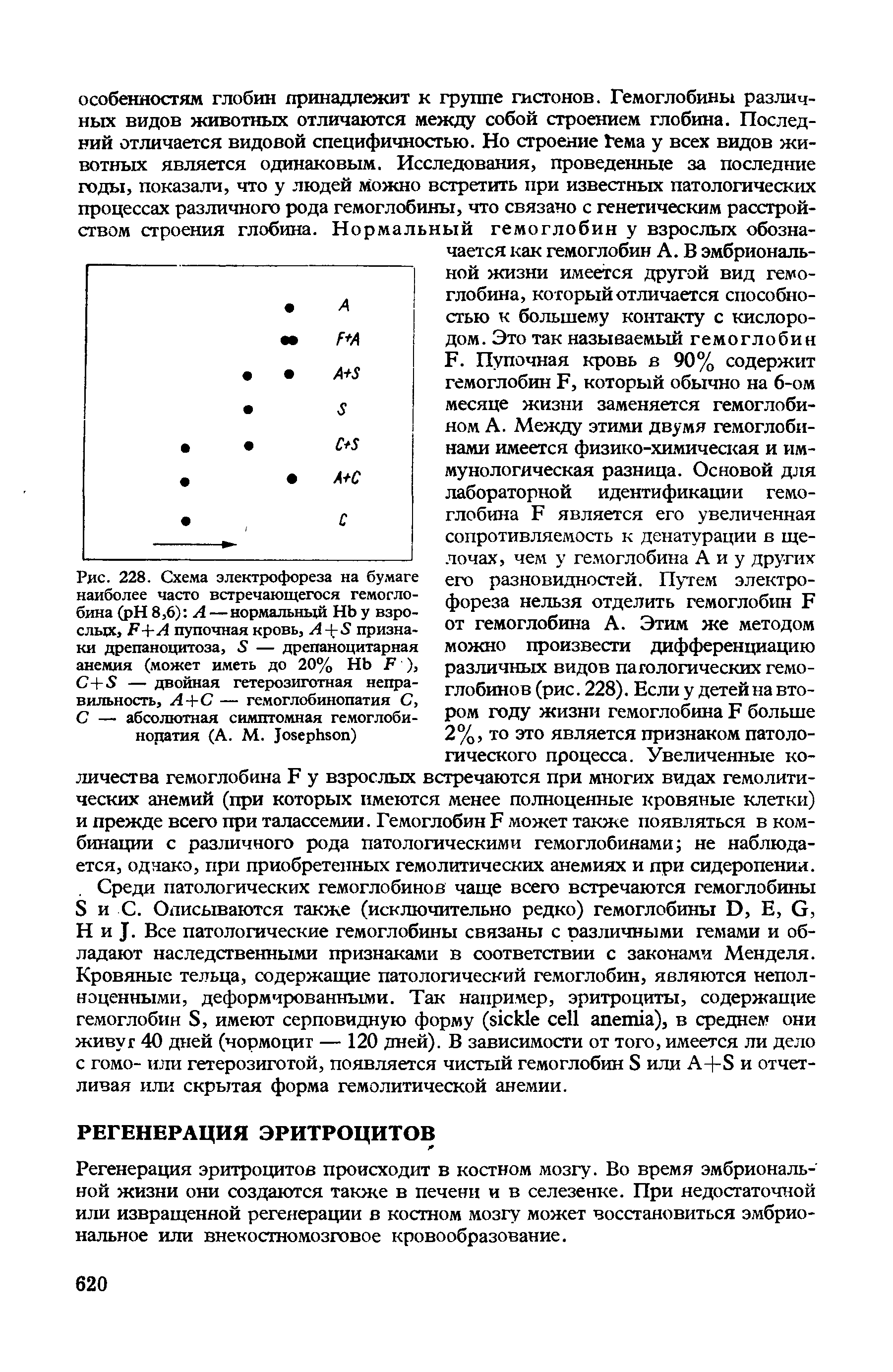 Рис. 228. Схема электрофореза на бумаге наиболее часто встречающегося гемоглобина ( H 8,6) А —нормальный НЬ у взрослых, F+A пупочная кровь, J + 5 признаки дрепаноцитоза, 5 — дрепаноцитарная анемия (может иметь до 20% H F ), С+5 — двойная гетерозиготная неправильность, А+С — гемоглобинопатия С, С — абсолютная симптомная гемоглобинопатия (А. М. J )...