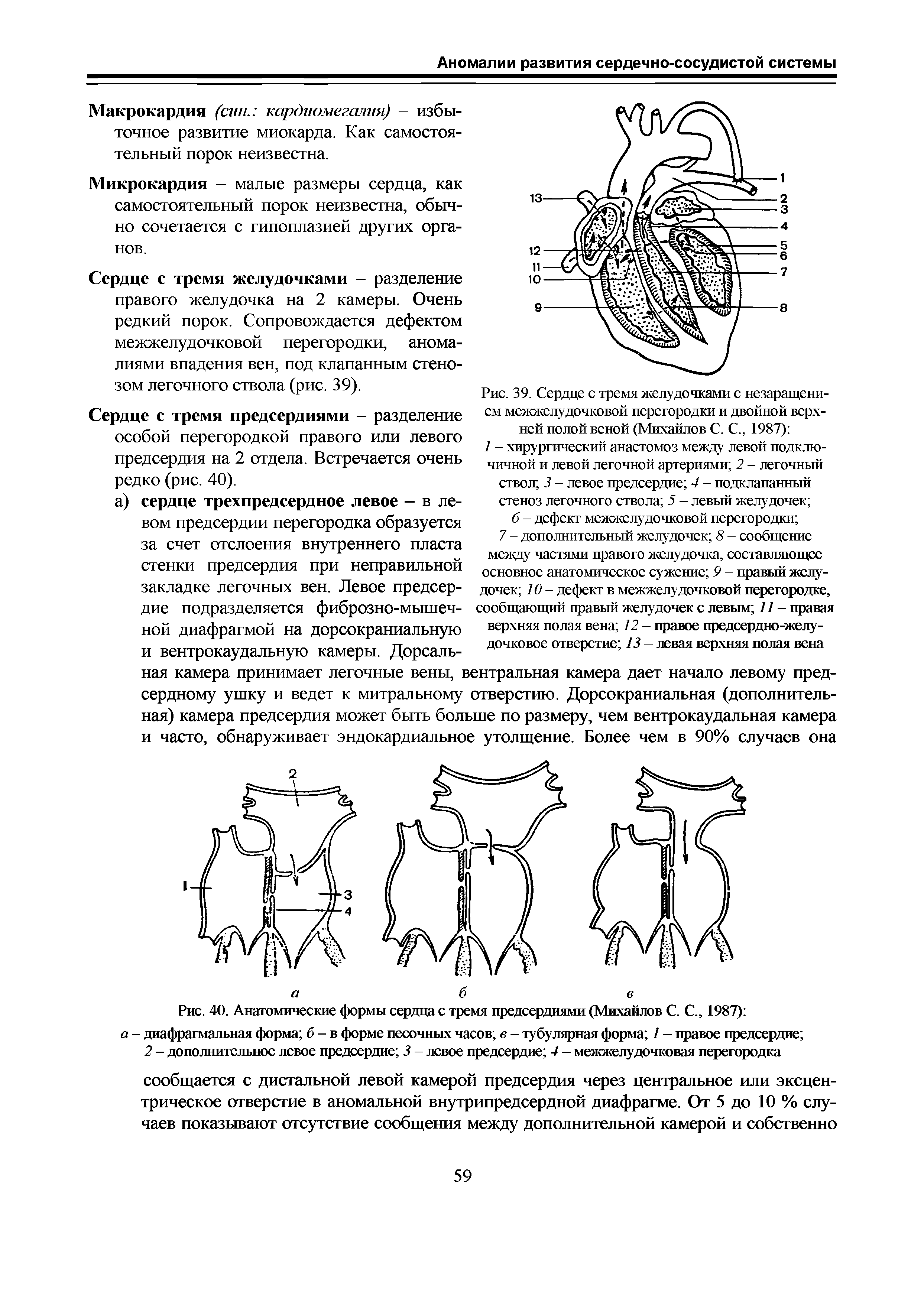 Рис. 40. Анатомические формы сердца с тремя предсердиями (Михайлов С. С., 1987) ...