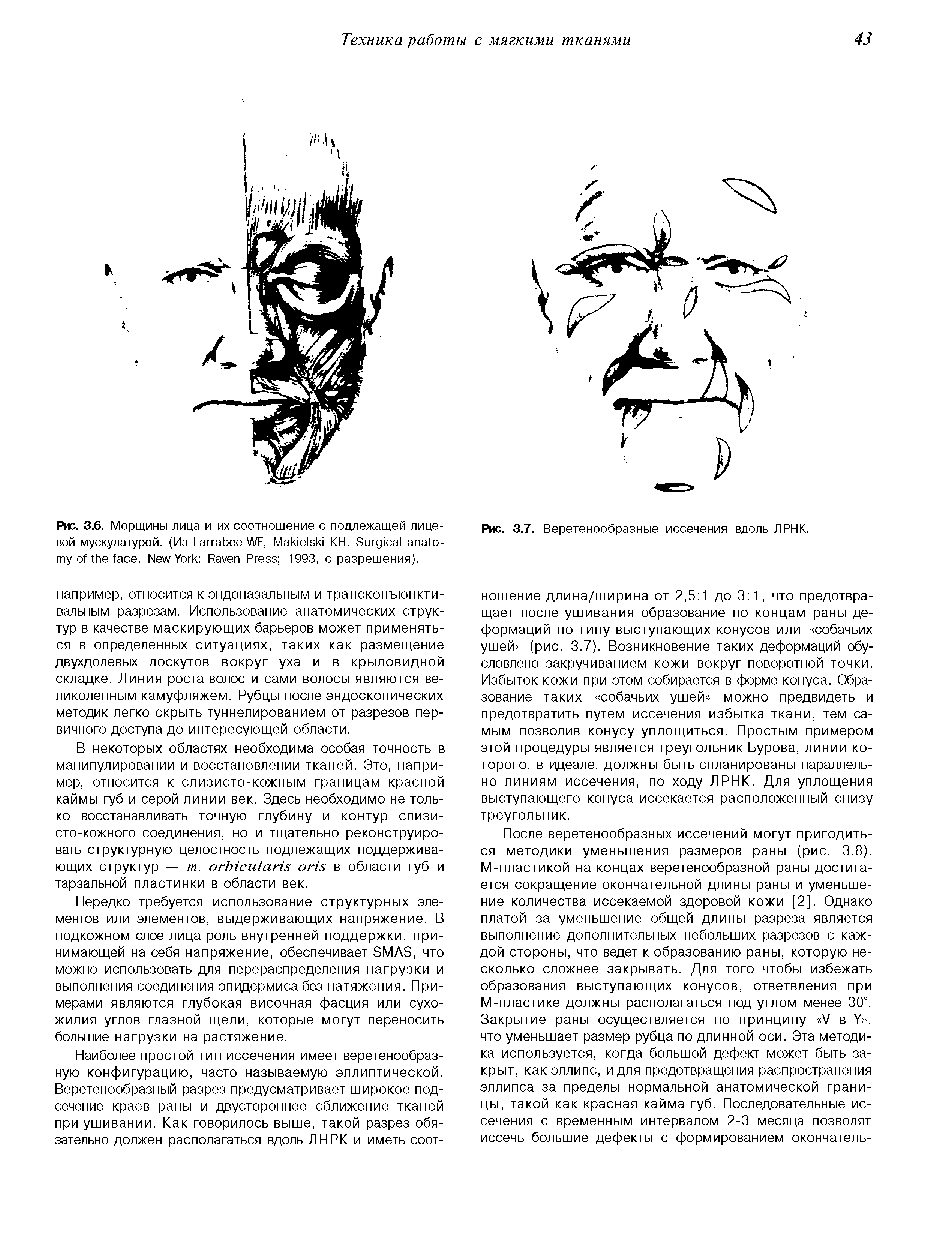 Рис. 3.6. Морщины лица и их соотношение с подлежащей лицевой мускулатурой. (Из L WF, M КН. S . N Y R P 1993, с разрешения).