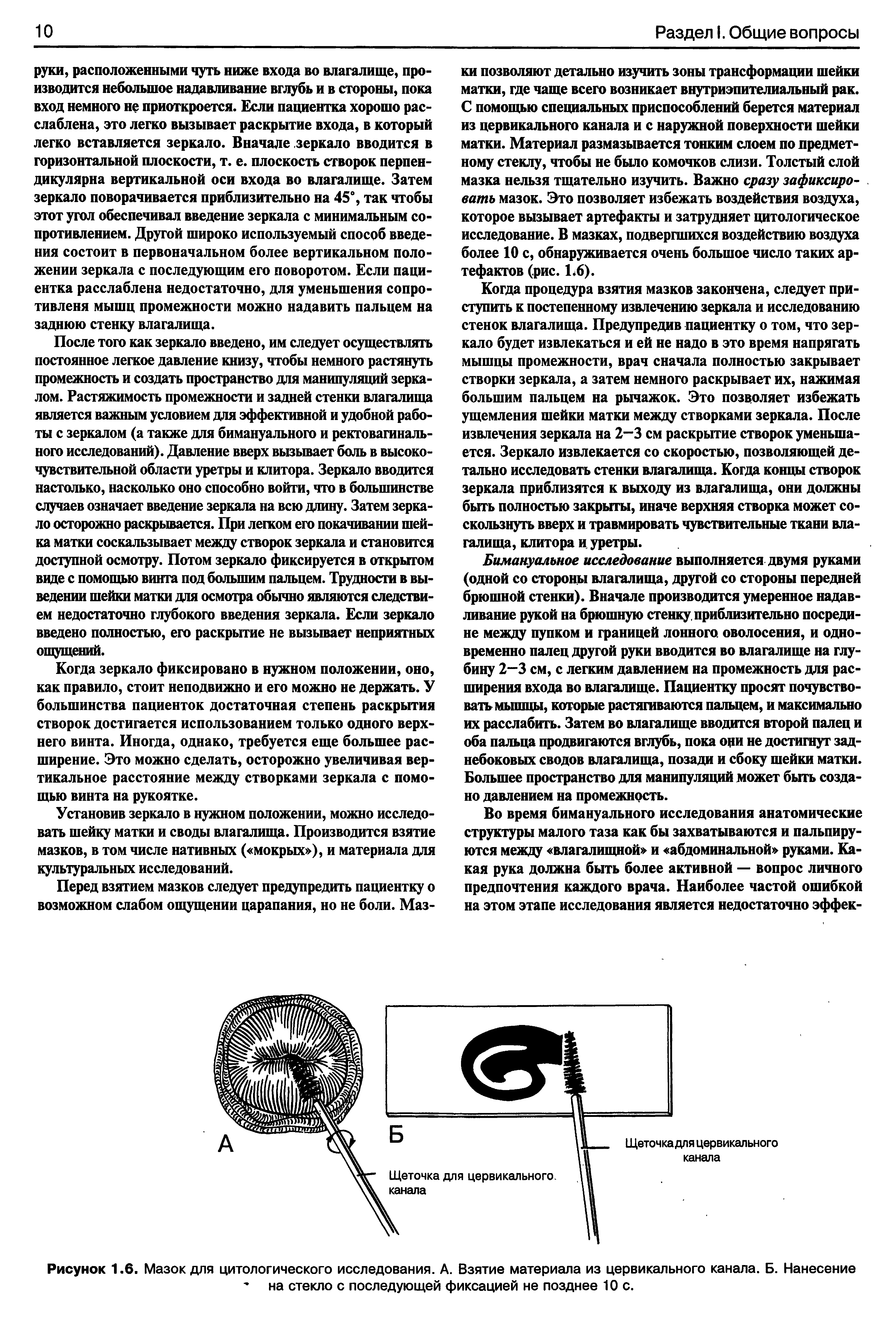 Рисунок 1.6. Мазок для цитологического исследования. А. Взятие материала из цервикального канала. Б. Нанесение на стекло с последующей фиксацией не позднее 10 с.