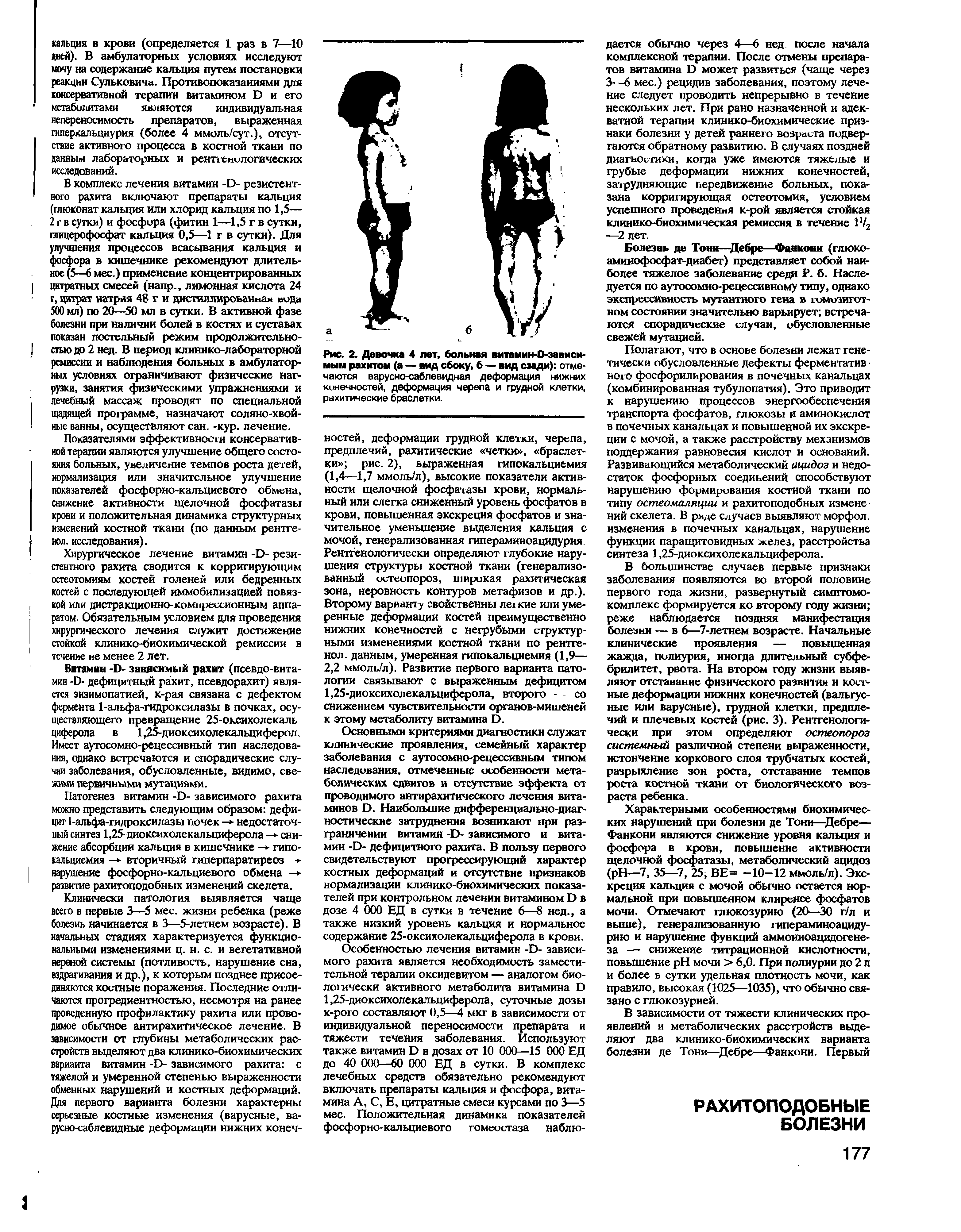 Рис. 2. Девочка 4 лет, больная витамин-Озависи-мым рахитом (а — вид сбоку, б — вид сзади) отмечаются варусно-саблевидная деформация нижних кинечностей, деформация черепа и грудной клетки, рахитические браслетки.