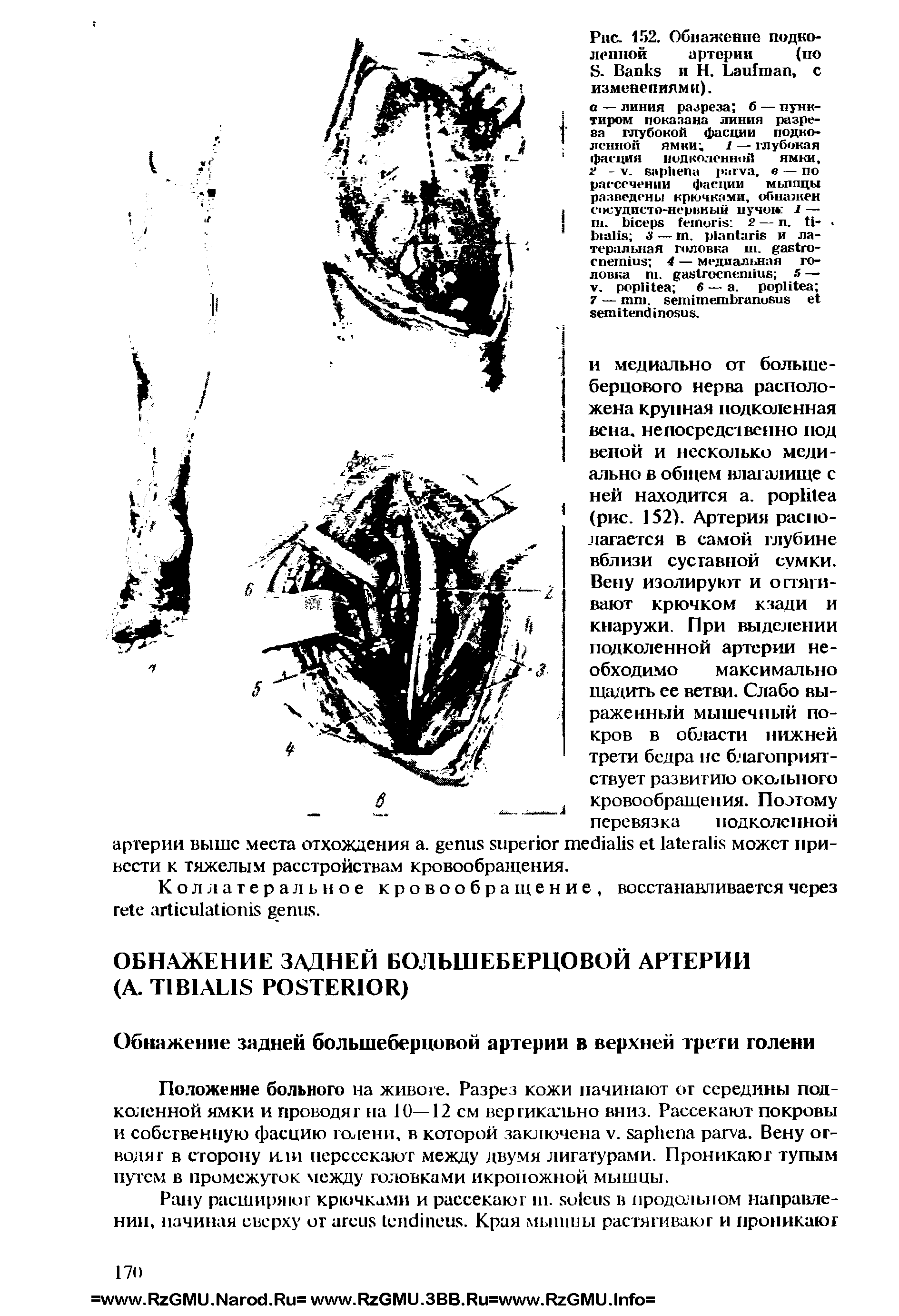 Рис. 152. Обнажение подколенной артерии (по S. B и Н. L , с изменениями).