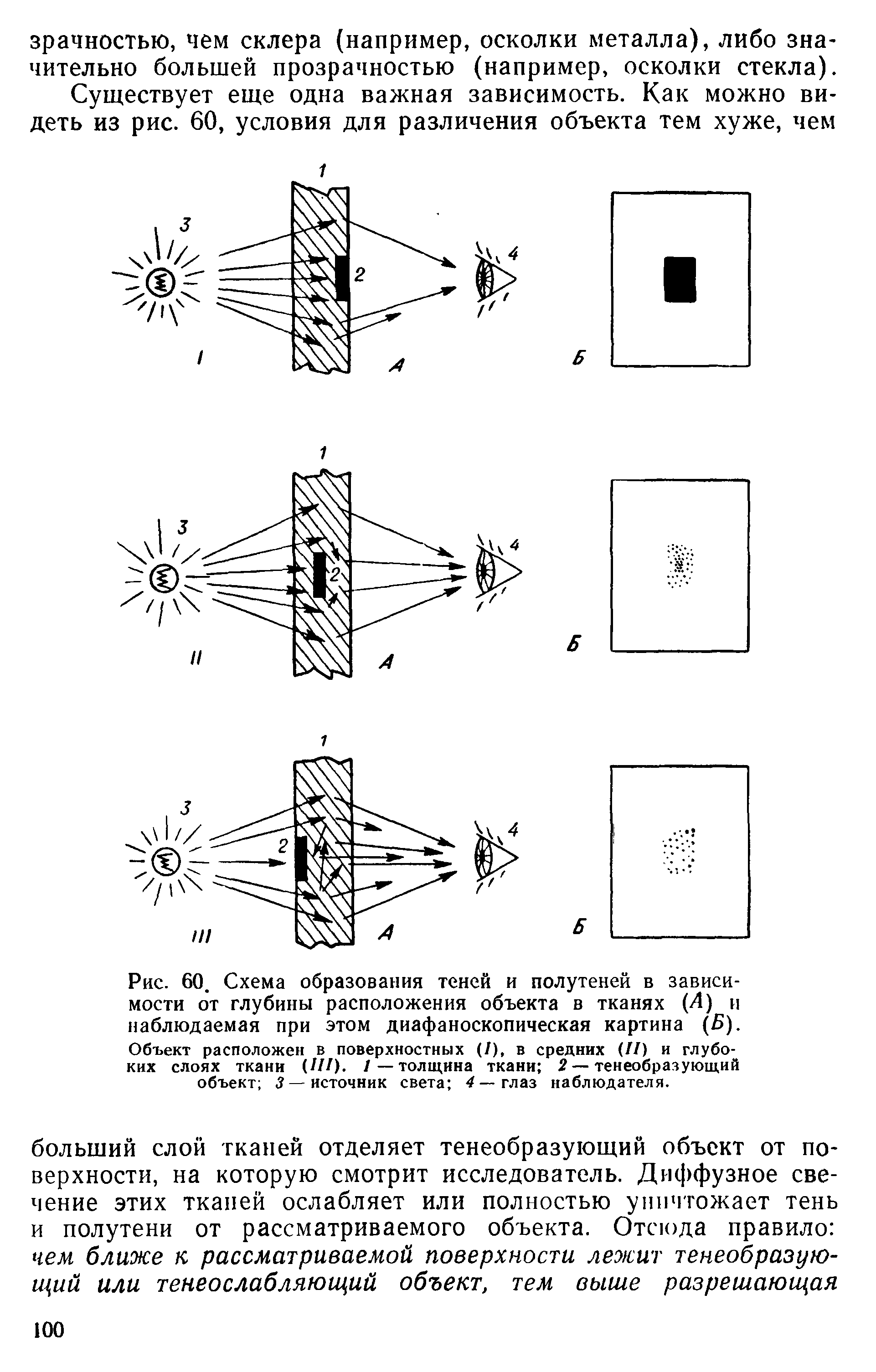 Рис. 60. Схема образования теней и полутеней в зависимости от глубины расположения объекта в тканях (Л) и наблюдаемая при этом диафаноскопическая картина (Б). Объект расположен в поверхностных (/), в средних (II) и глубоких слоях ткани (III). /—толщина ткани 2— тенеобразующий объект 3— источник света 4— глаз наблюдателя.
