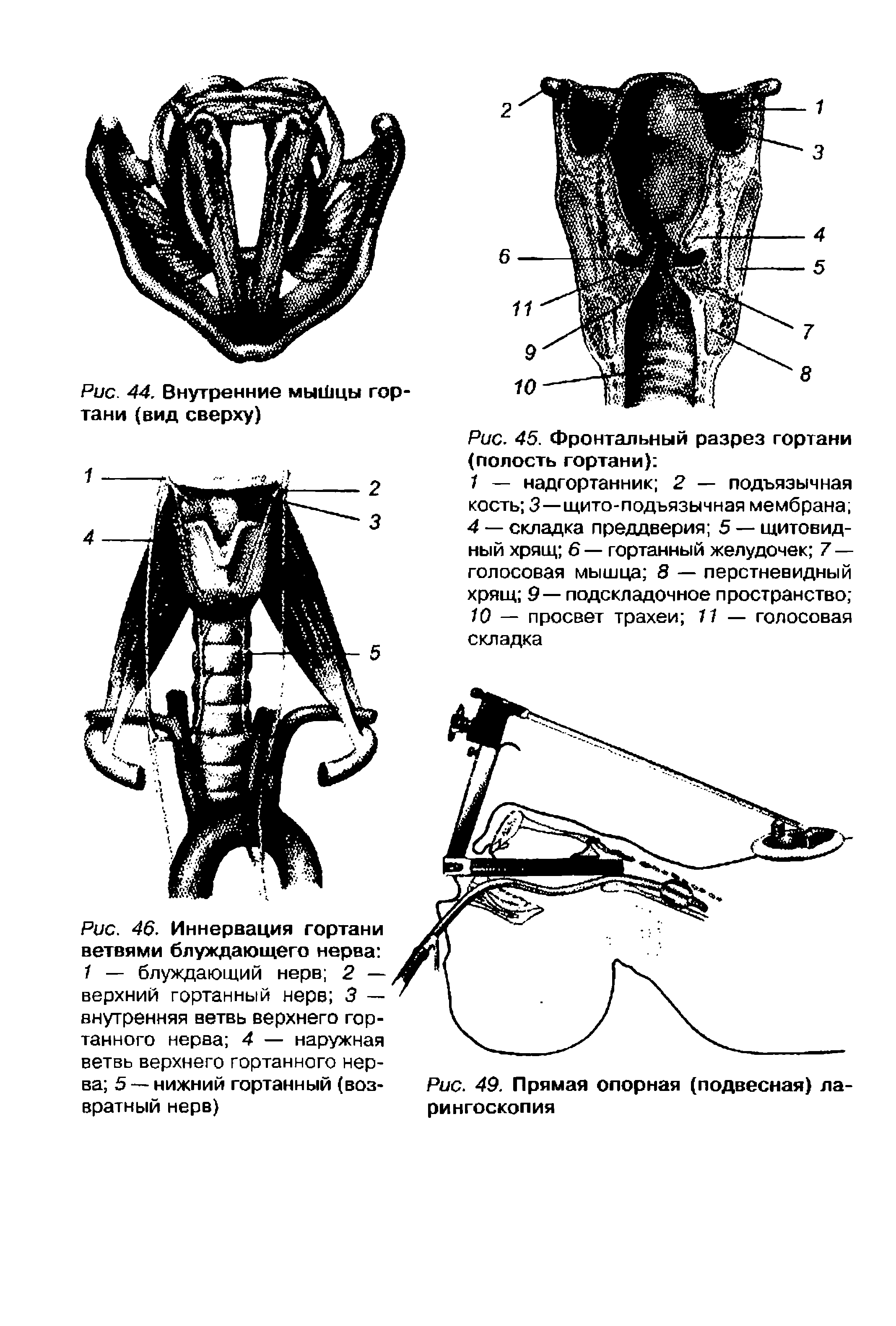 Рис. 46. Иннервация гортани ветвями блуждающего нерва 7 — блуждающий нерв 2 — верхний гортанный нерв 3 — внутренняя ветвь верхнего гортанного нерва 4 — наружная ветвь верхнего гортанного нер-...