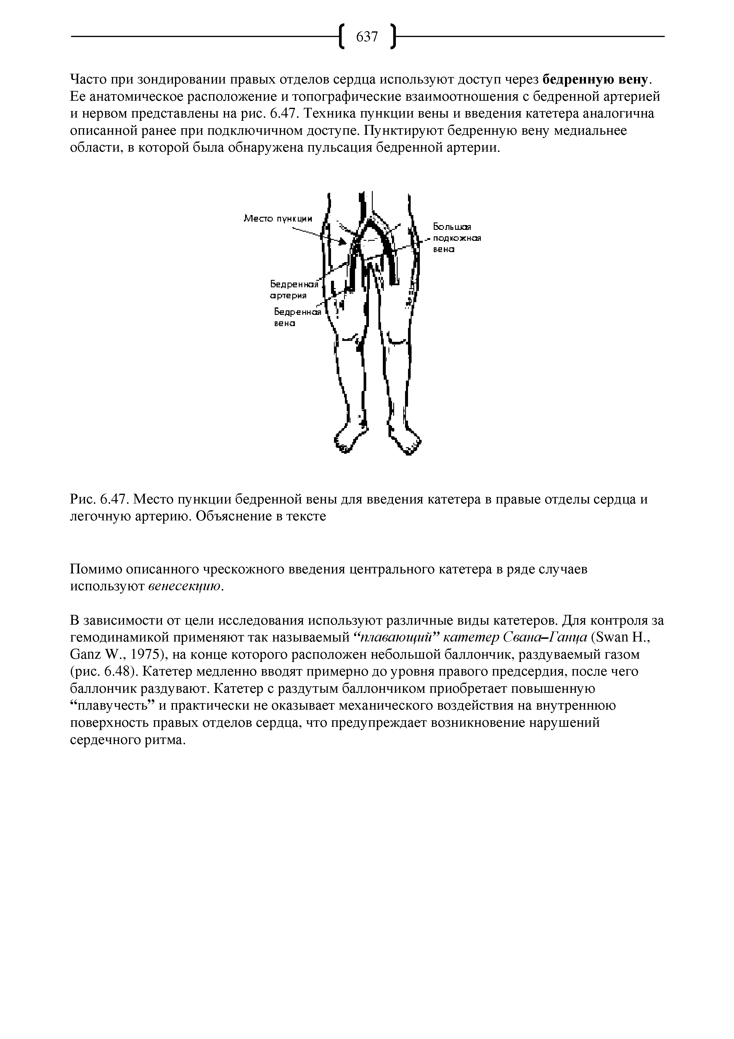 Рис. 6.47. Место пункции бедренной вены для введения катетера в правые отделы сердца и легочную артерию. Объяснение в тексте...
