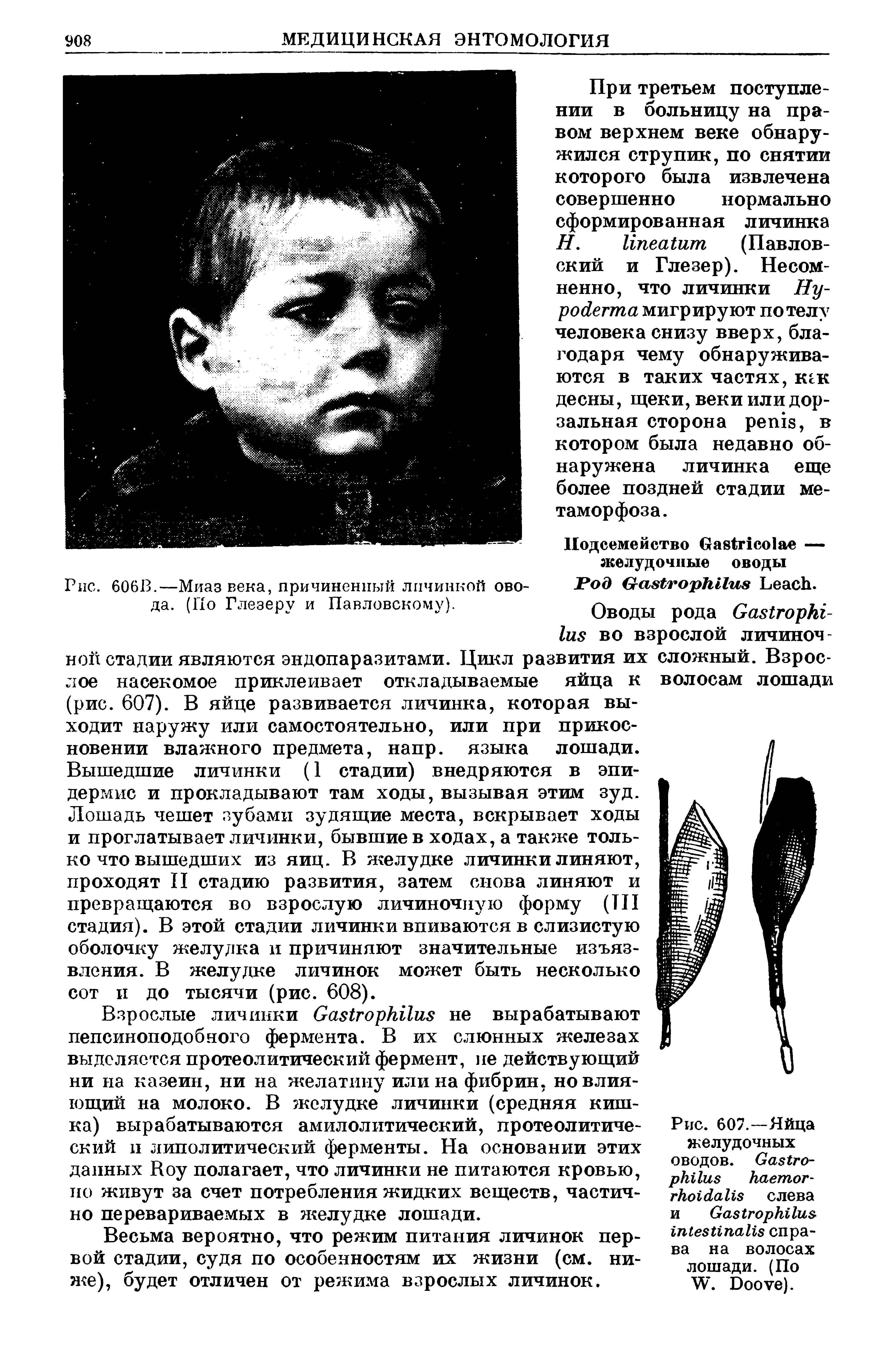 Рис. 607.—Яйца желудочных оводов. G - слева и G справа на волосах лошади. (По W. D ).