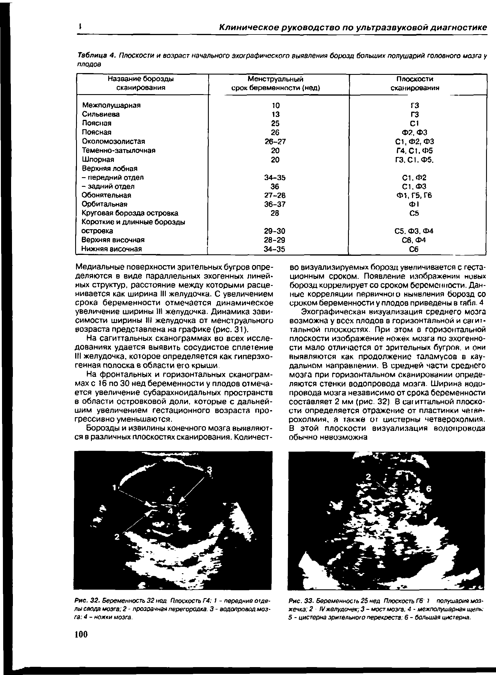 Таблица 4. Плоскости и возраст начального эхографического выявления борозд больших полушарий головного мозга у плодов...