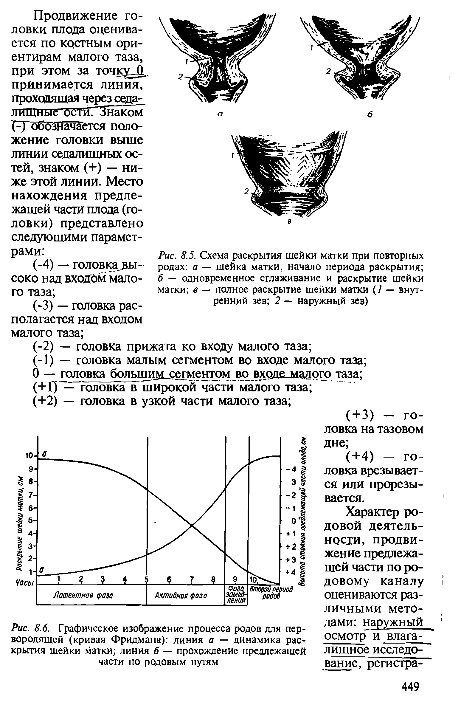 Рис. 8.6. Графическое изображение процесса родов для первородящей (кривая Фридмана) линия а — динамика раскрытия шейки матки линия б — прохождение предлежащей части по родовым путям...