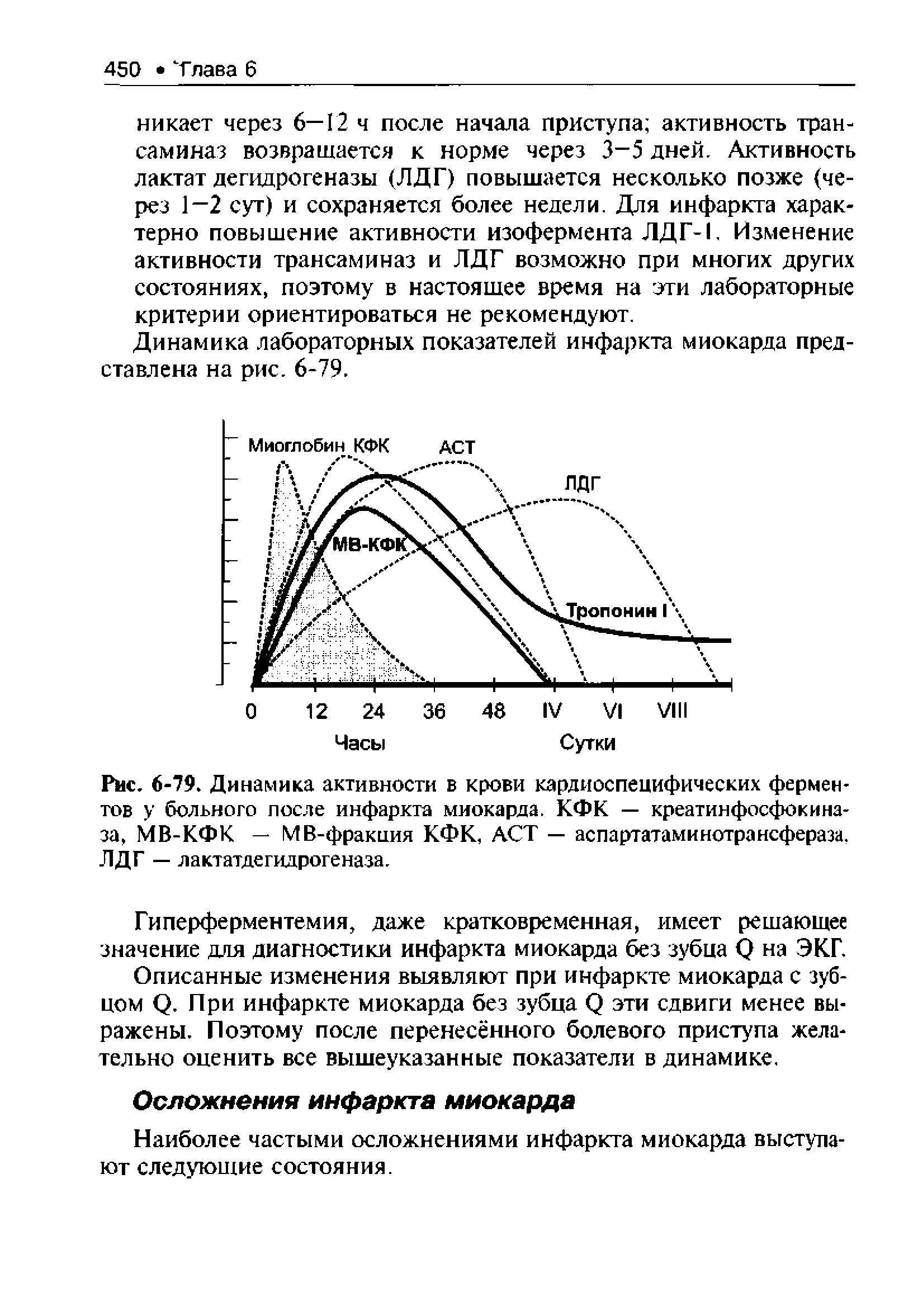 Рис. 6-79. Динамика активности в крови кардиоспецифических ферментов у больного после инфаркта миокарда. КФК — креатинфосфокиназа, МВ-КФК — МВ-фракиия КФК, ACT — аспартатаминотрансфераза. ЛДГ — лактатде гидрогеназа.