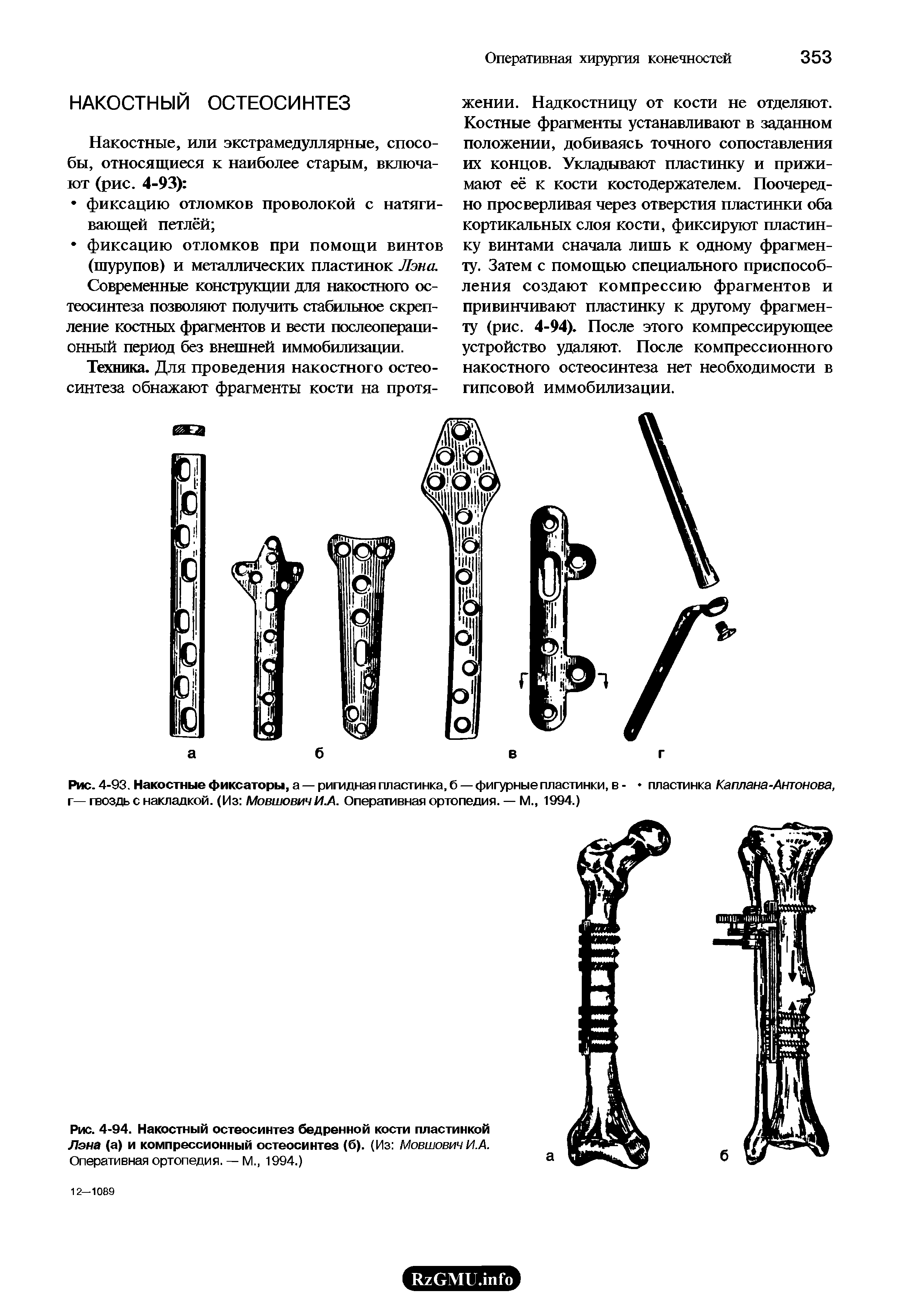 Рис. 4-94. Накостный остеосинтез бедренной кости пластинкой Лэна (а) и компрессионный остеосинтез (б). (Из Мовшович И.А. Оперативная ортопедия. — М., 1994.)...