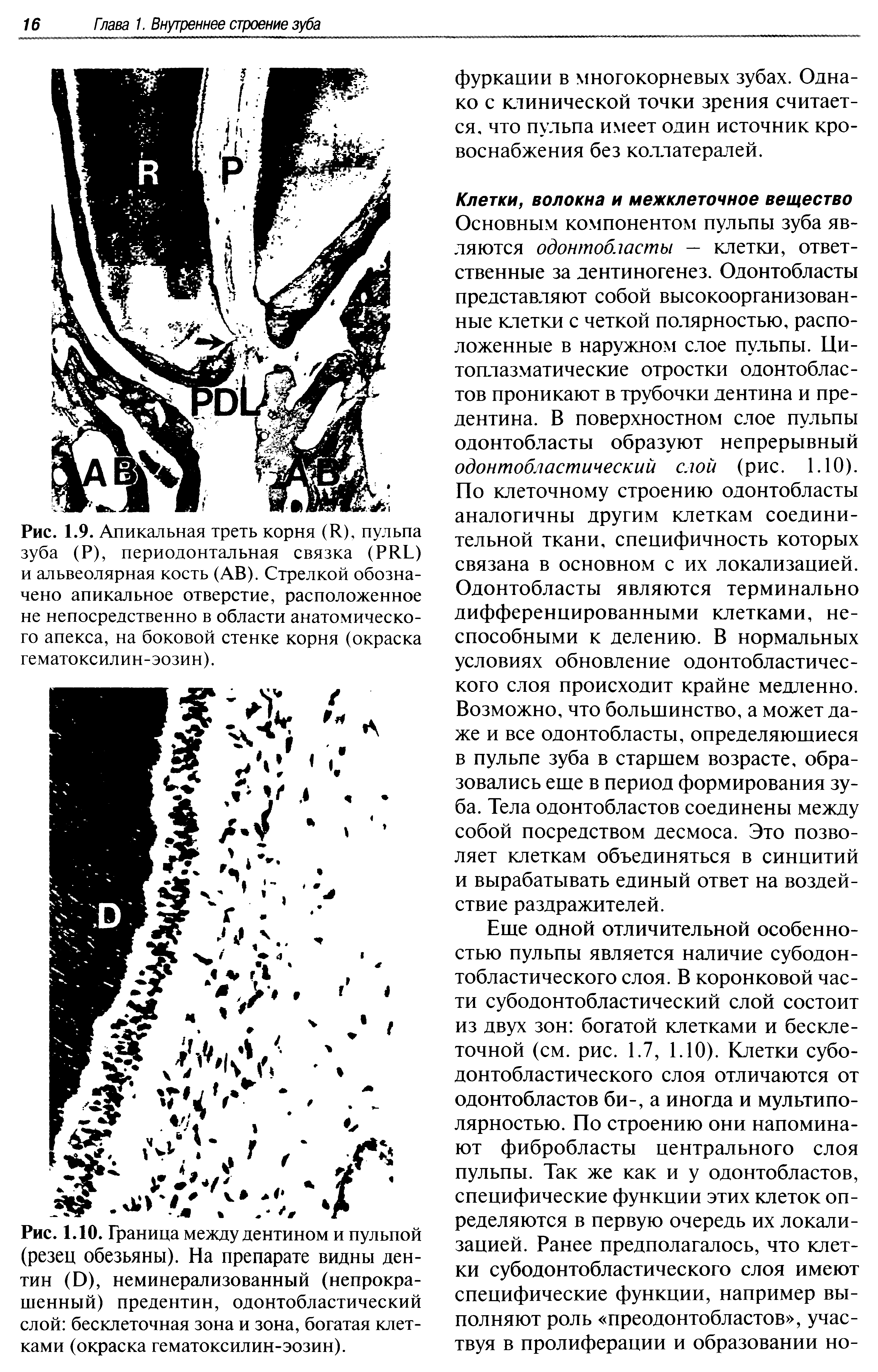 Рис. 1.10. Граница между дентином и пульпой (резец обезьяны). На препарате видны дентин (Э), неминерализованный (непрокра-шенный) предентин, одонтобластический слой бесклеточная зона и зона, богатая клетками (окраска гематоксилин-эозин).