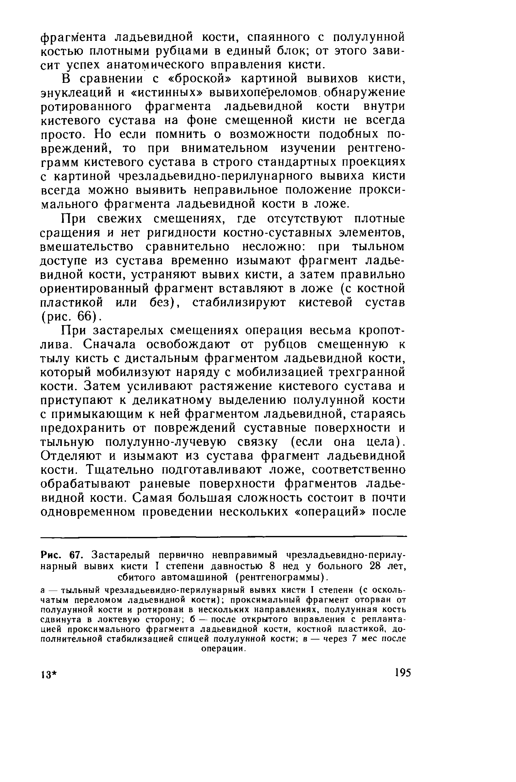 Рис. 67. Застарелый первично невправимый чрезладьевидно-перилу-нарный вывих кисти I степени давностью 8 нед у больного 28 лет, сбитого автомашиной (рентгенограммы).